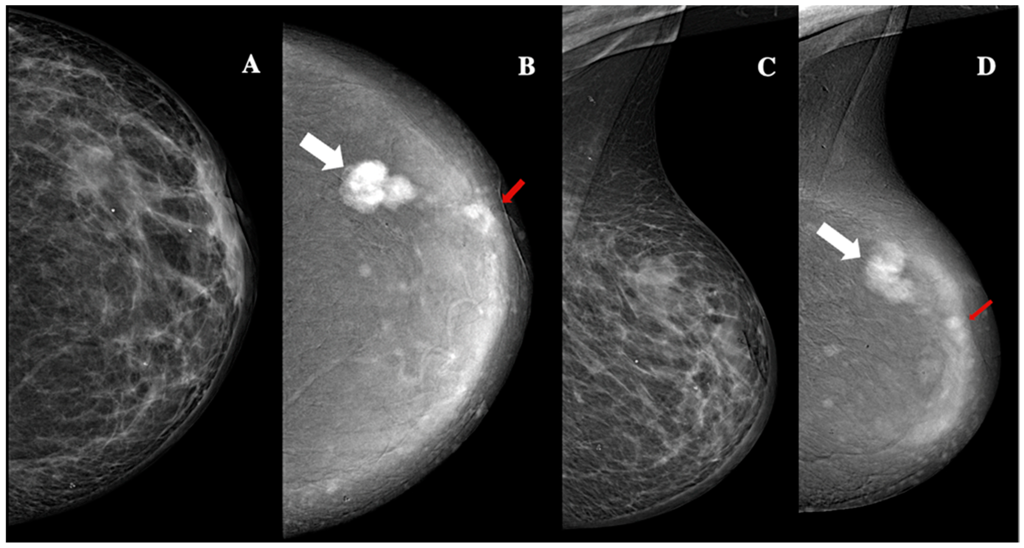 Jimaging 11 00080 g007