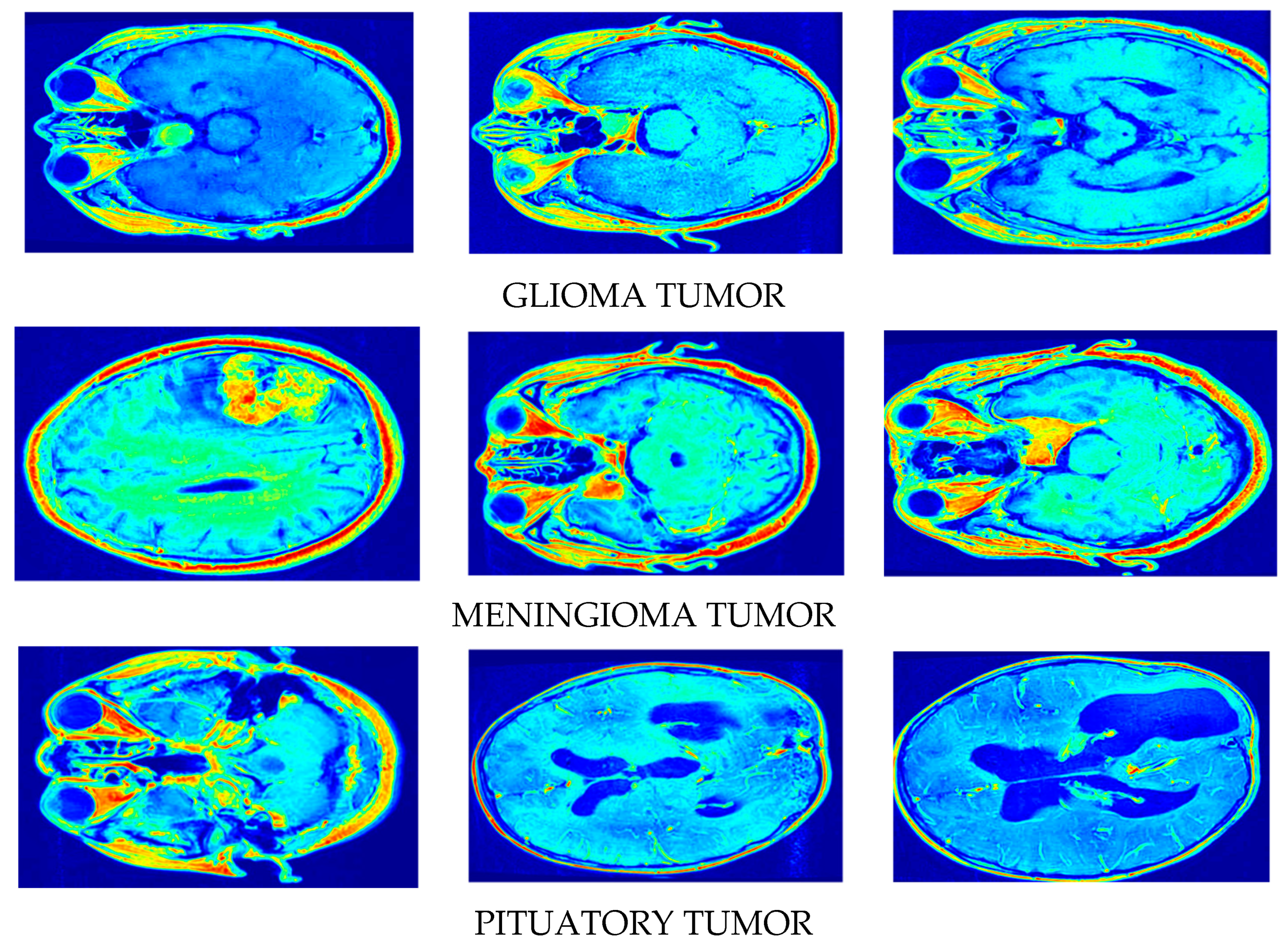 Jimaging 11 00101 g005