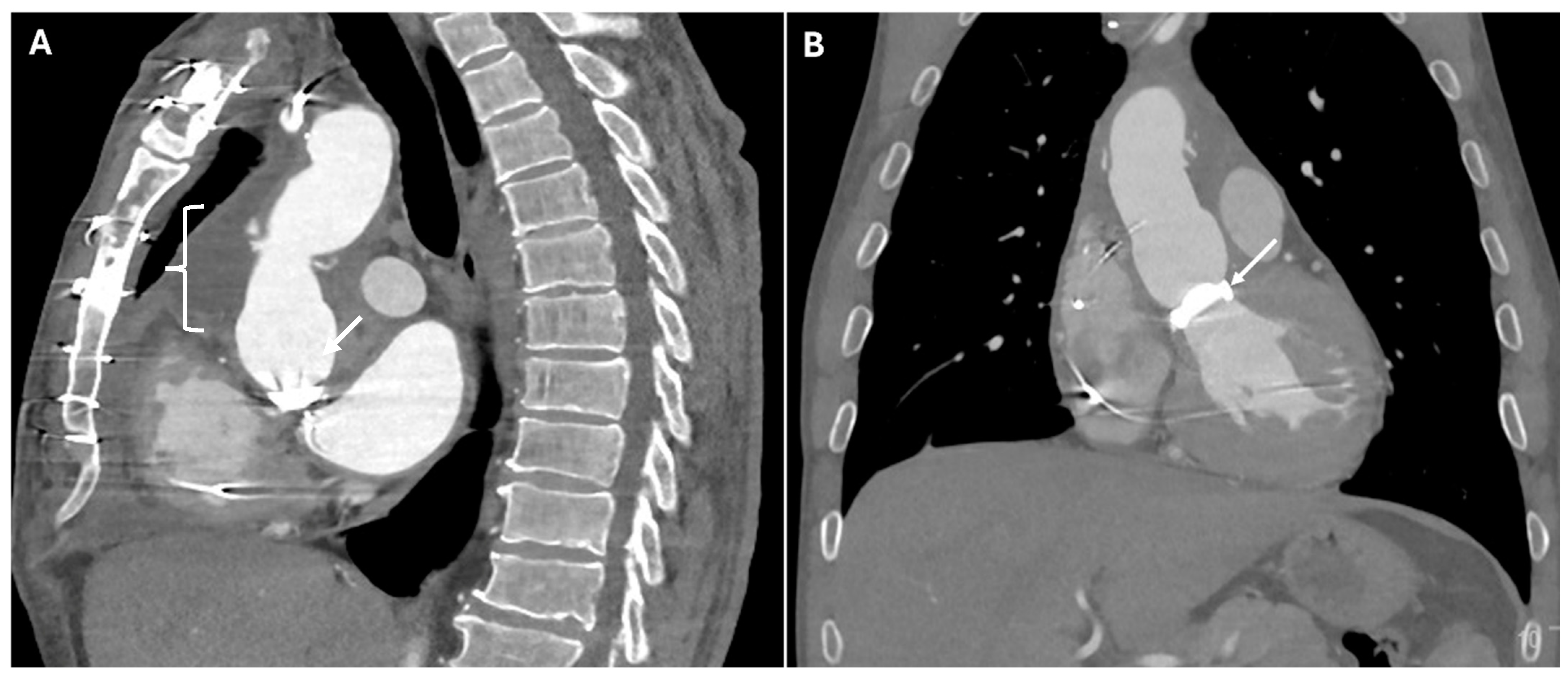 Jimaging 11 00119 g002