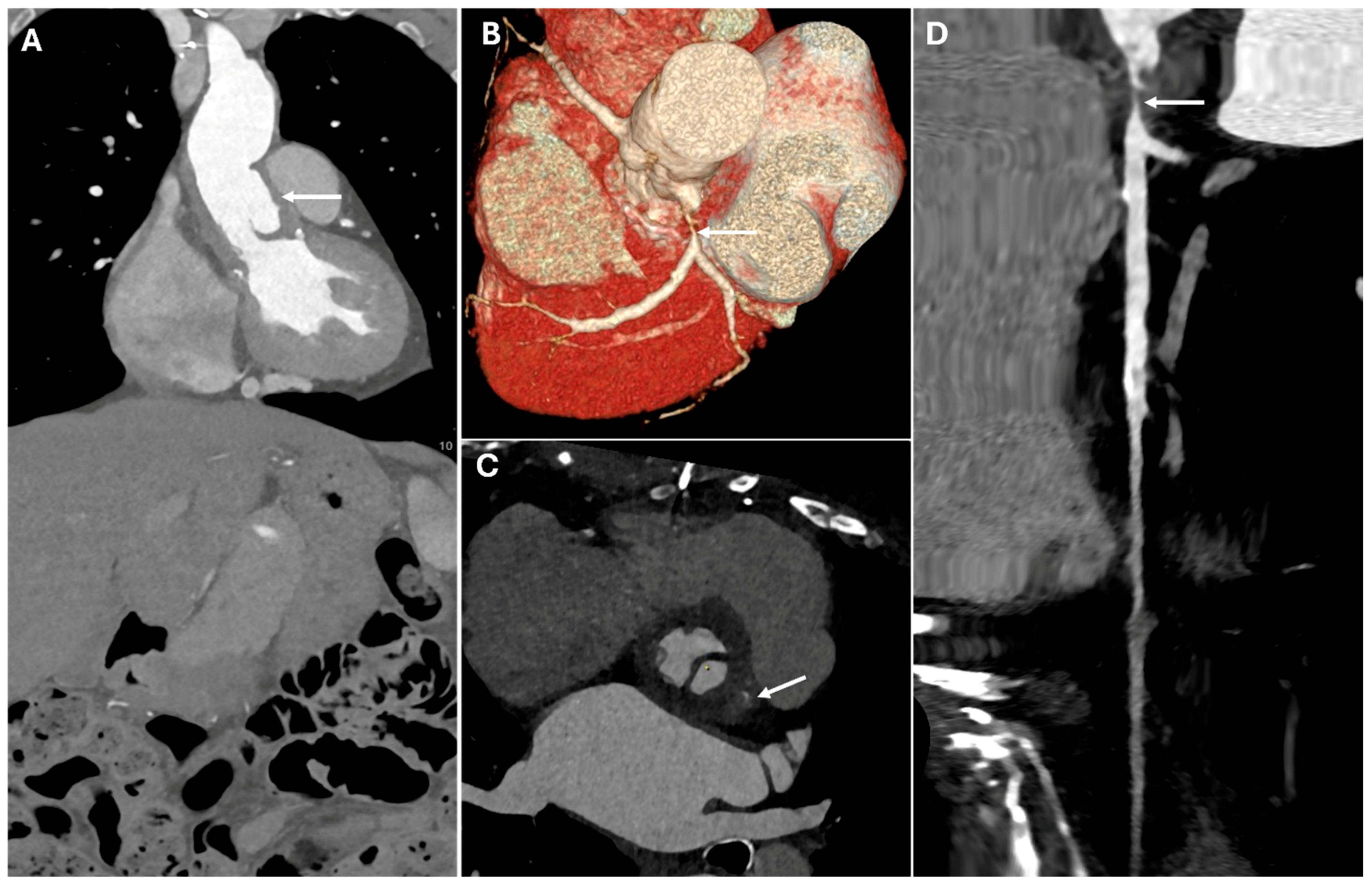 Jimaging 11 00119 g005