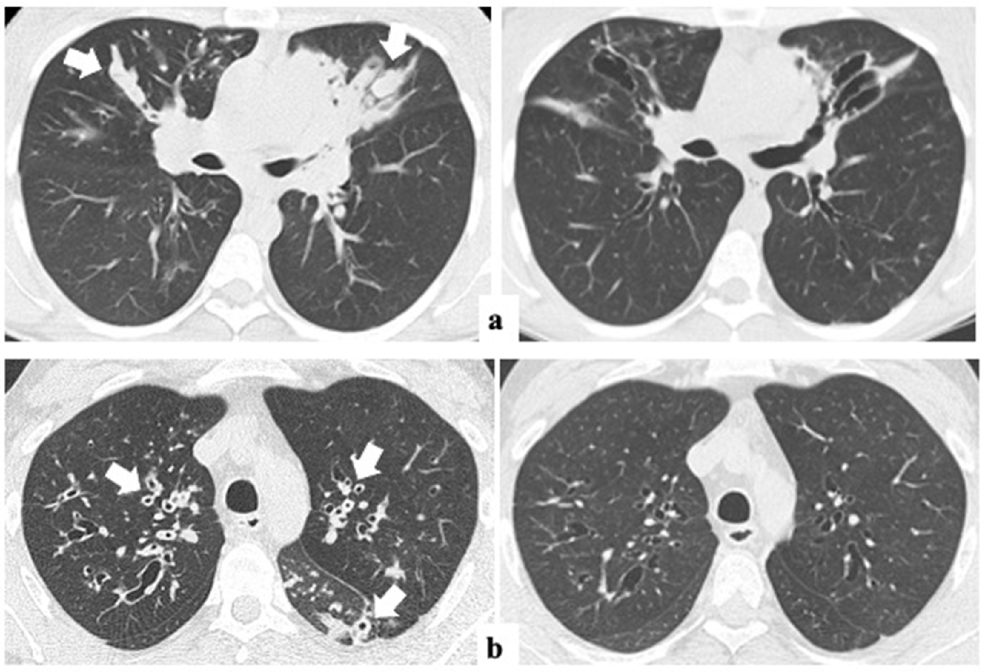 Jimaging 11 00124 g002