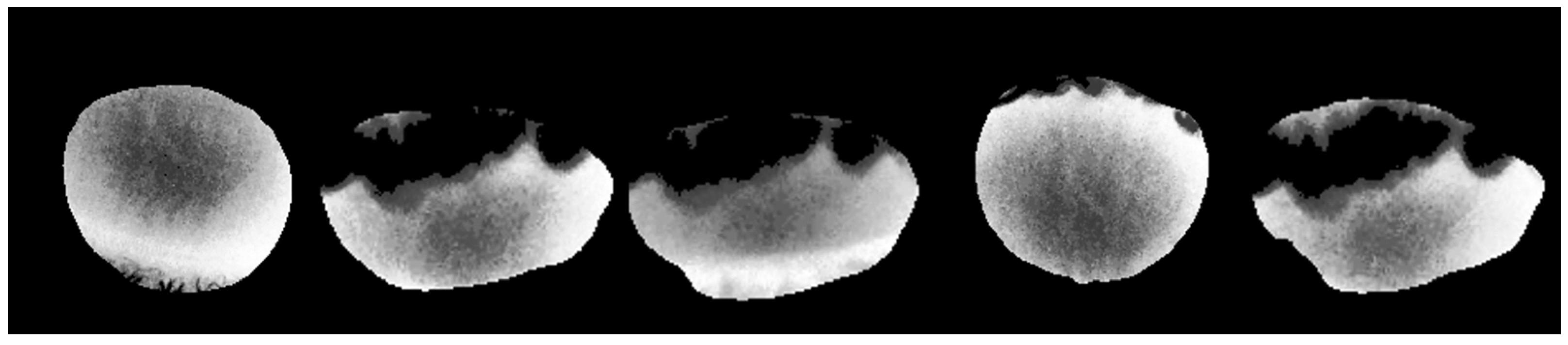 Jimaging 11 00131 g003