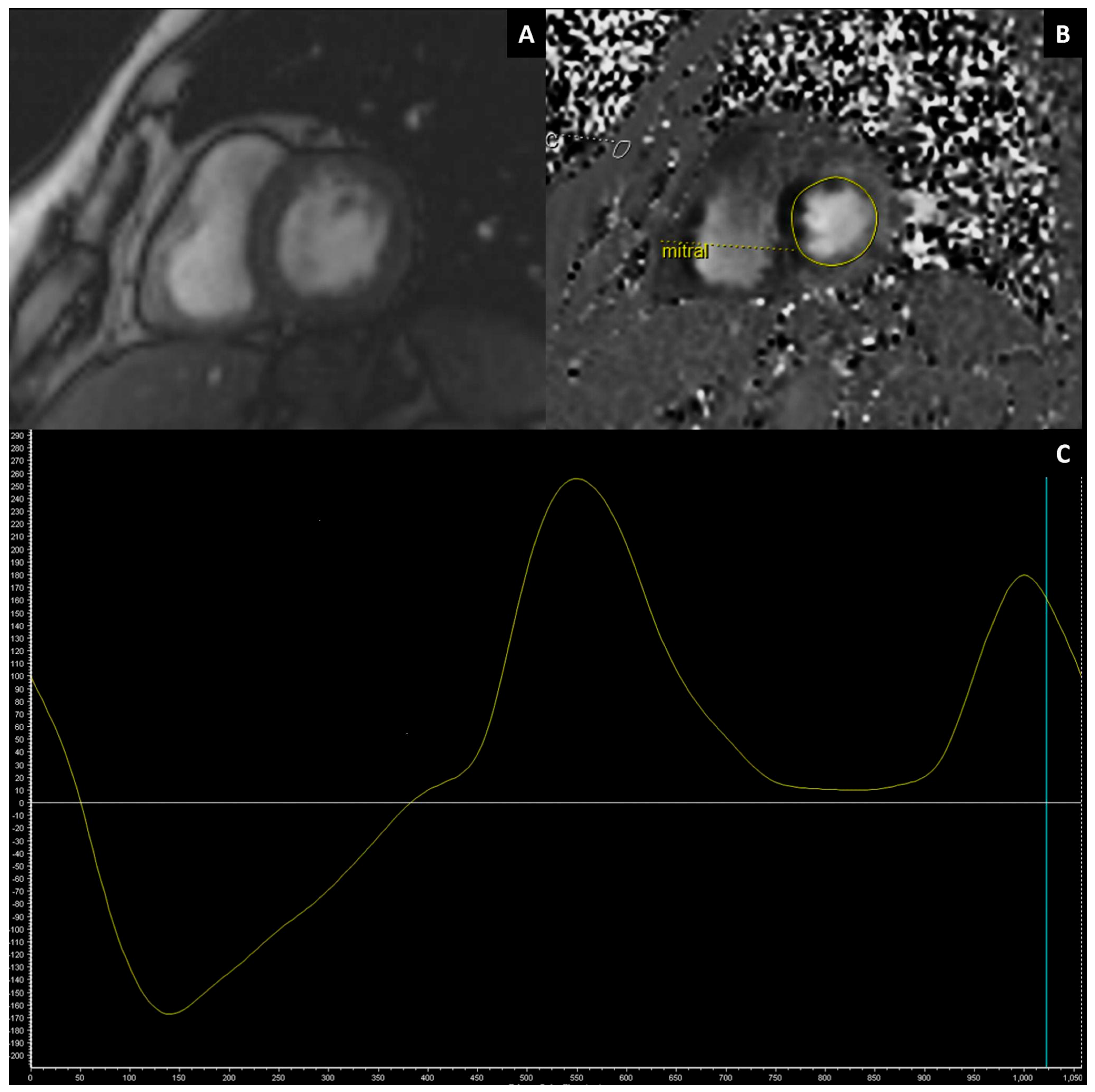 Jimaging 11 00143 g004 Jimaging 11 00143 g004