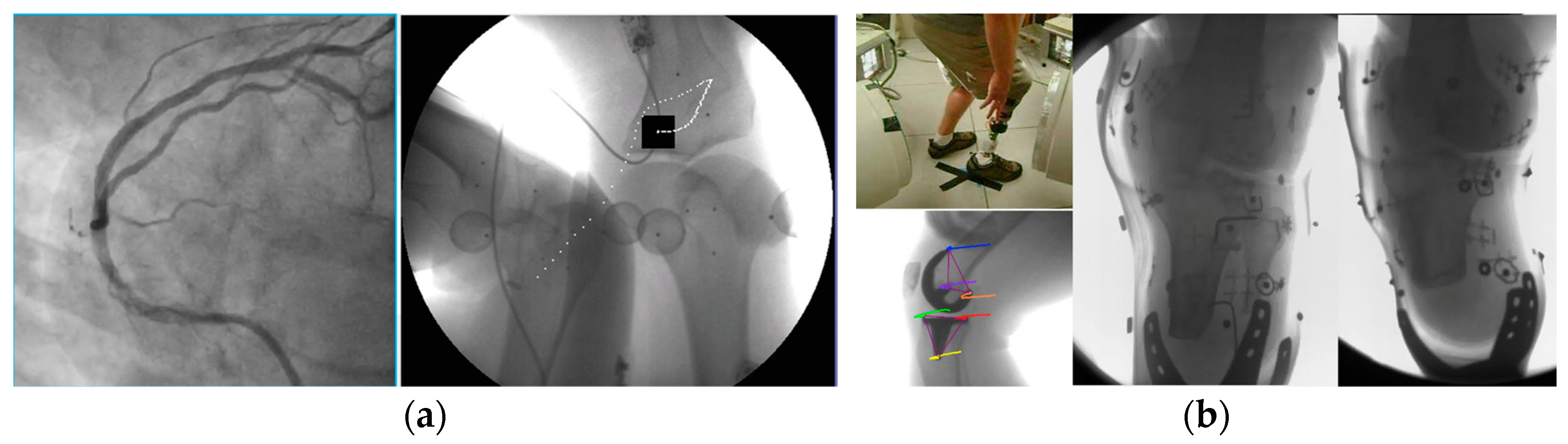 Jimaging 11 00147 g003