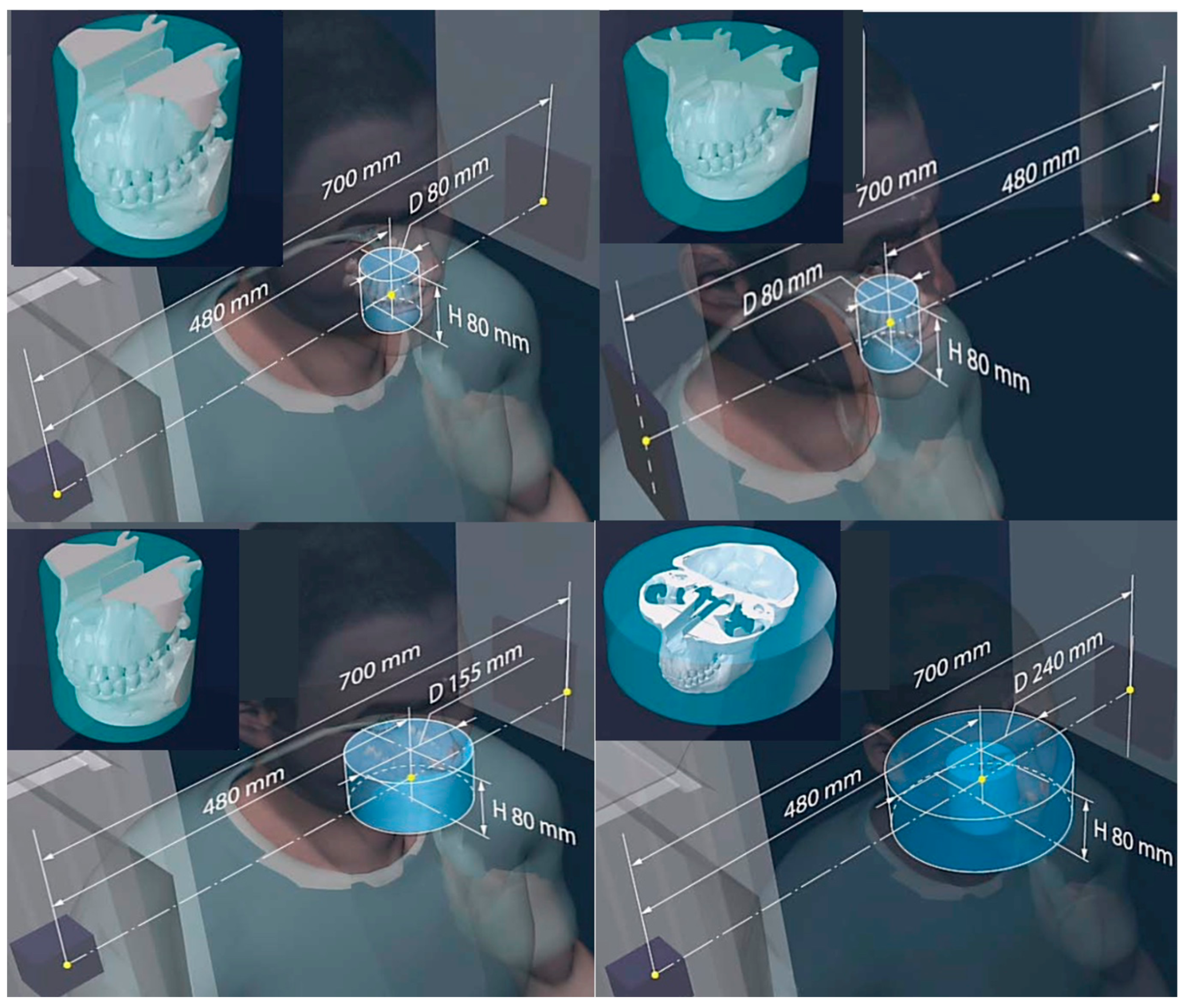 Jimaging 11 00147 g006