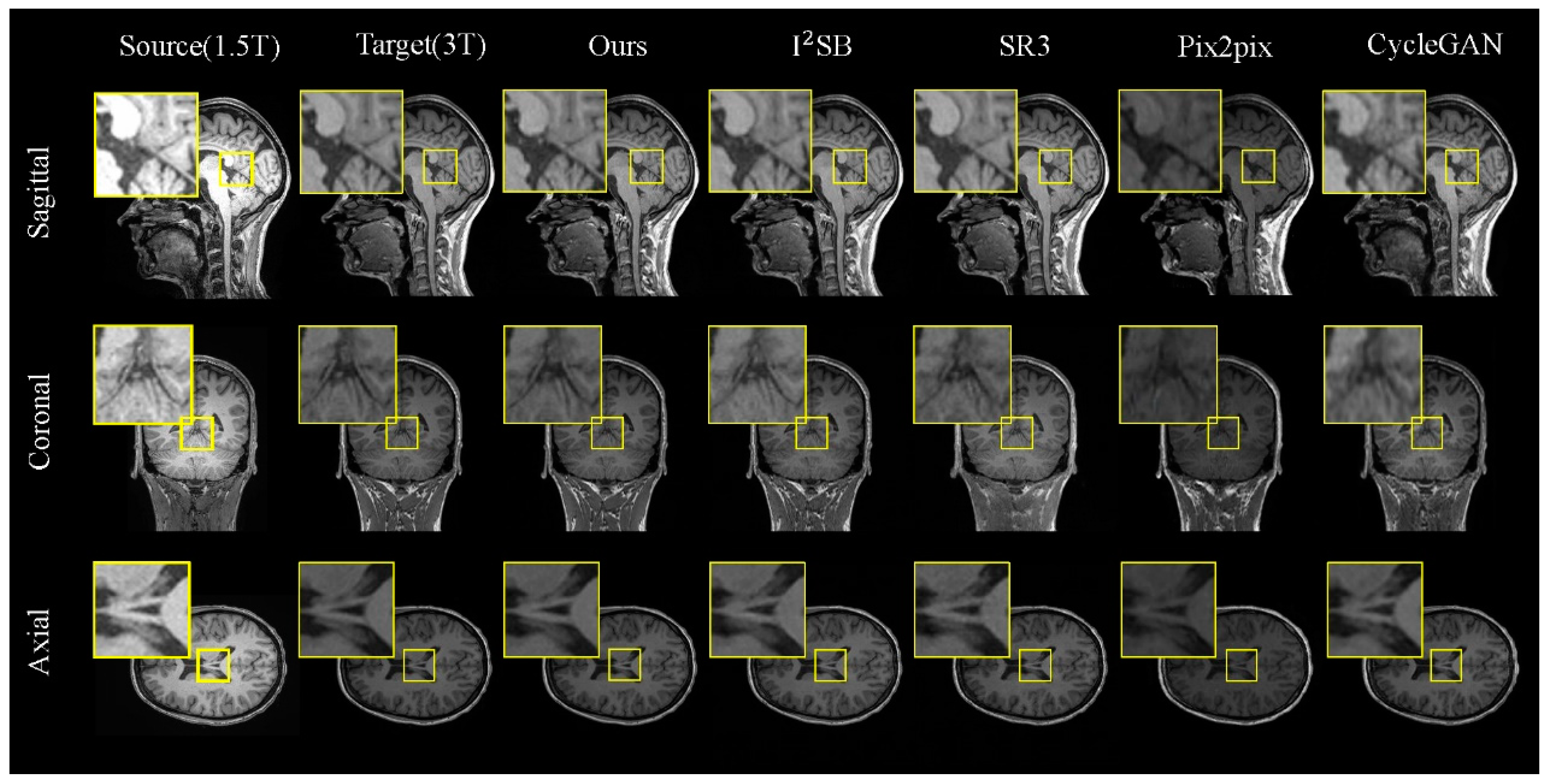 Jimaging 11 00152 g005