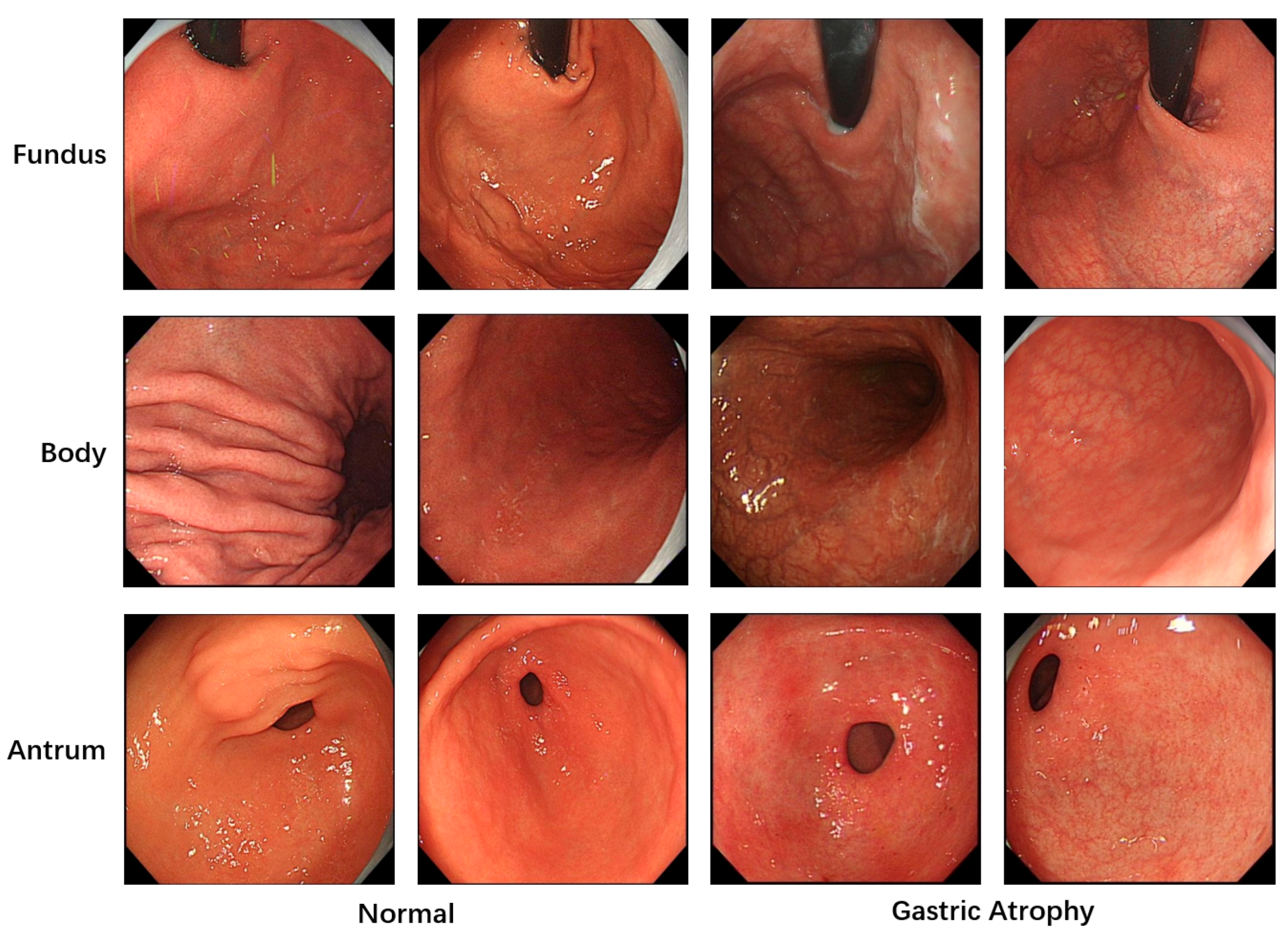 Jimaging 11 00154 g001