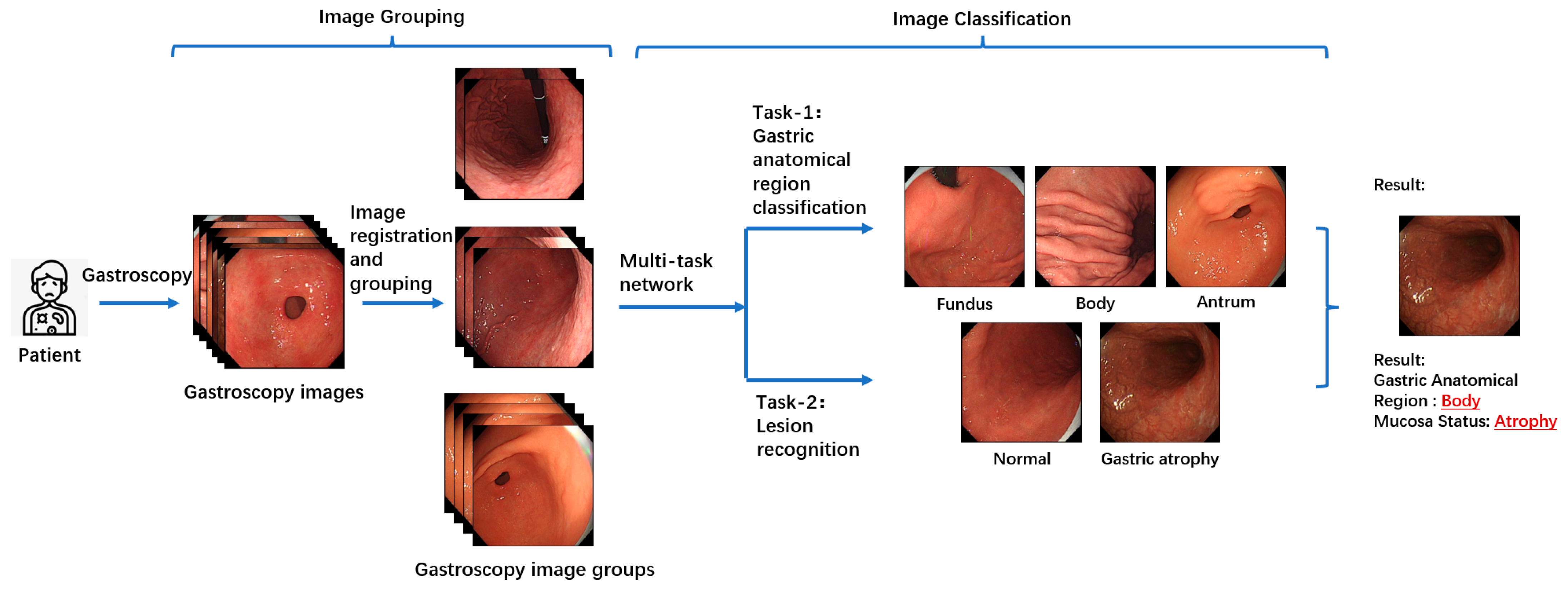 Jimaging 11 00154 g002