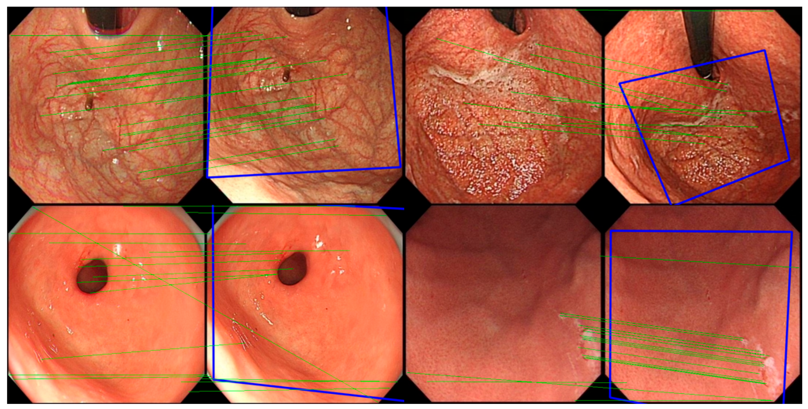 Jimaging 11 00154 g004