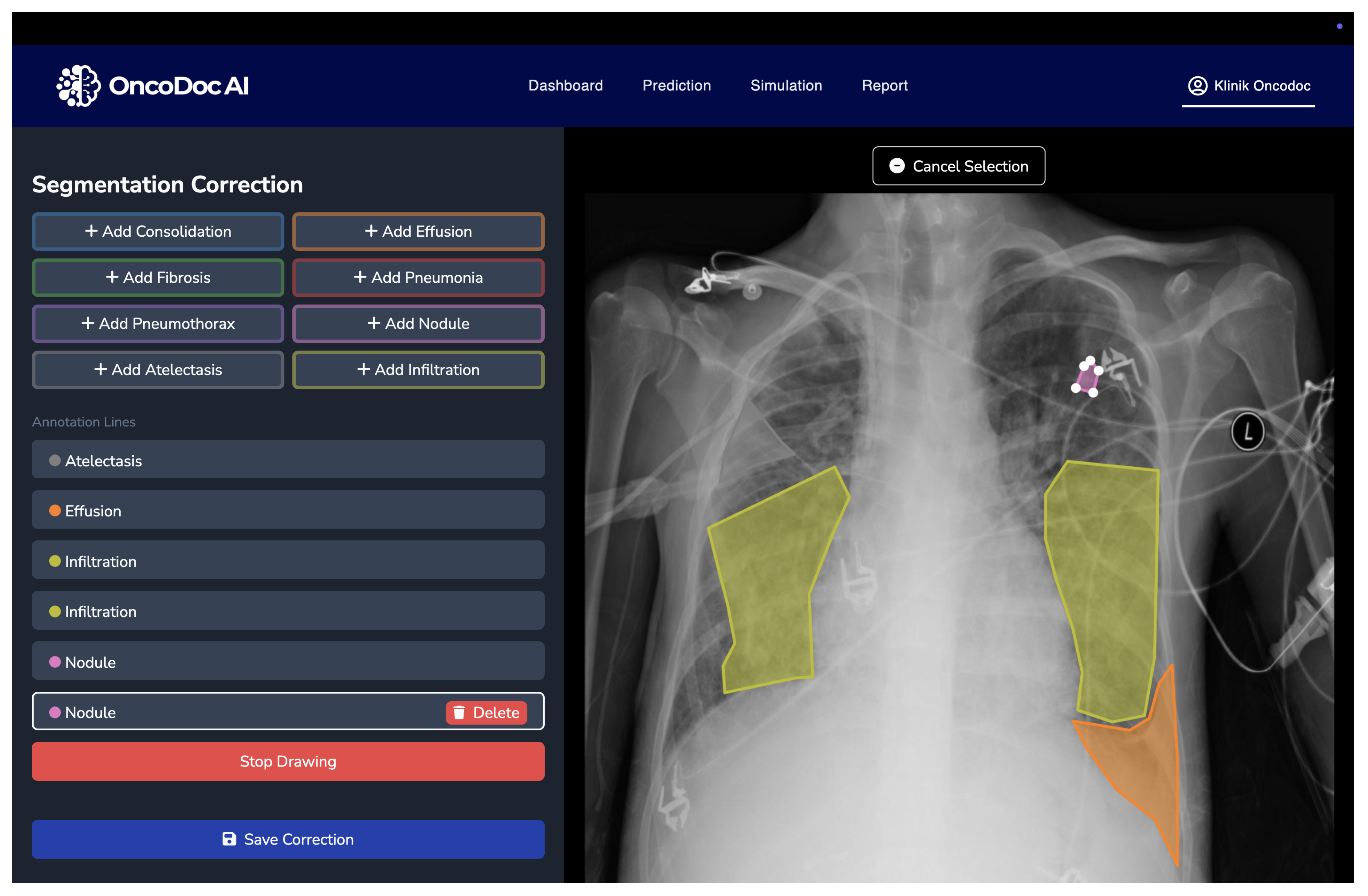 Jimaging 11 00186 g002
