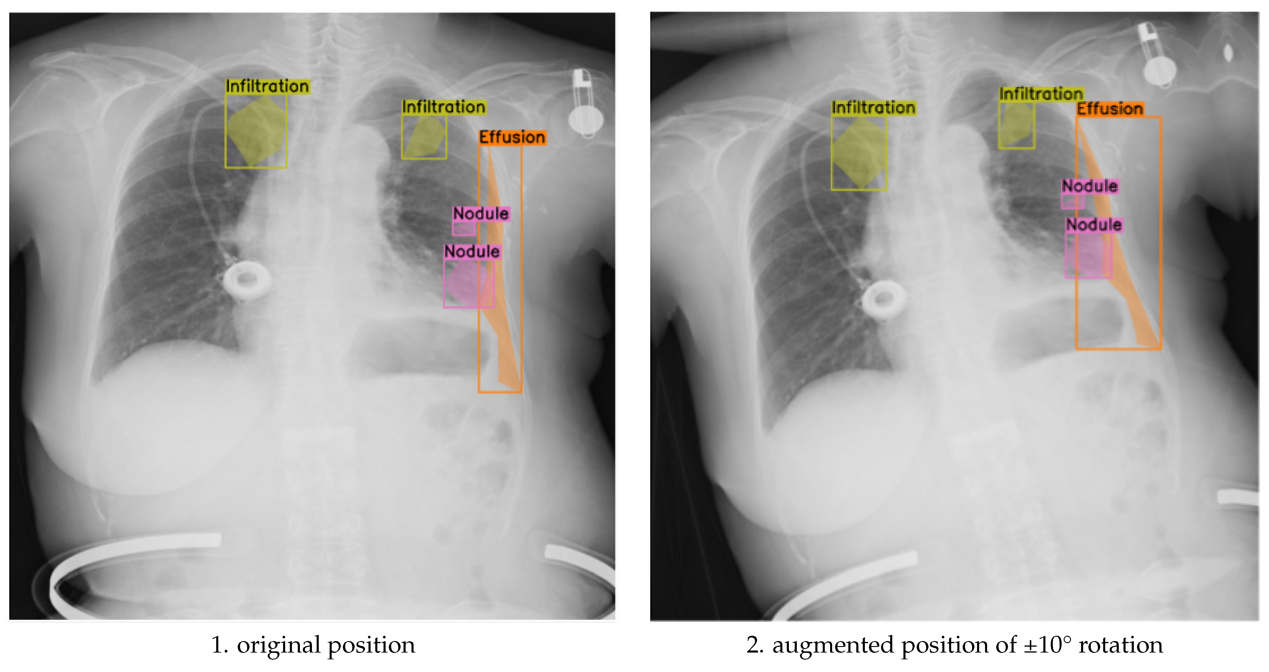Jimaging 11 00186 g003