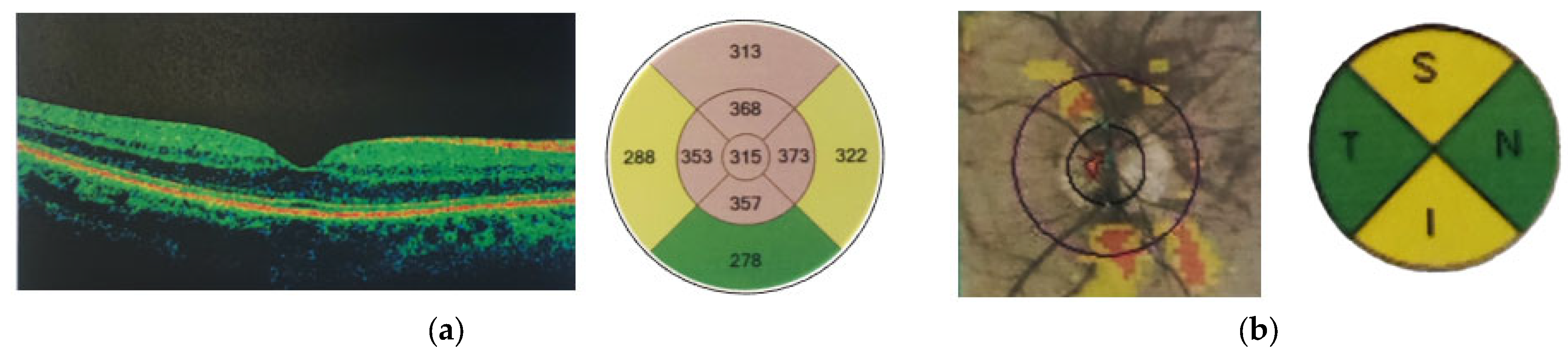 Jimaging 11 00195 g001