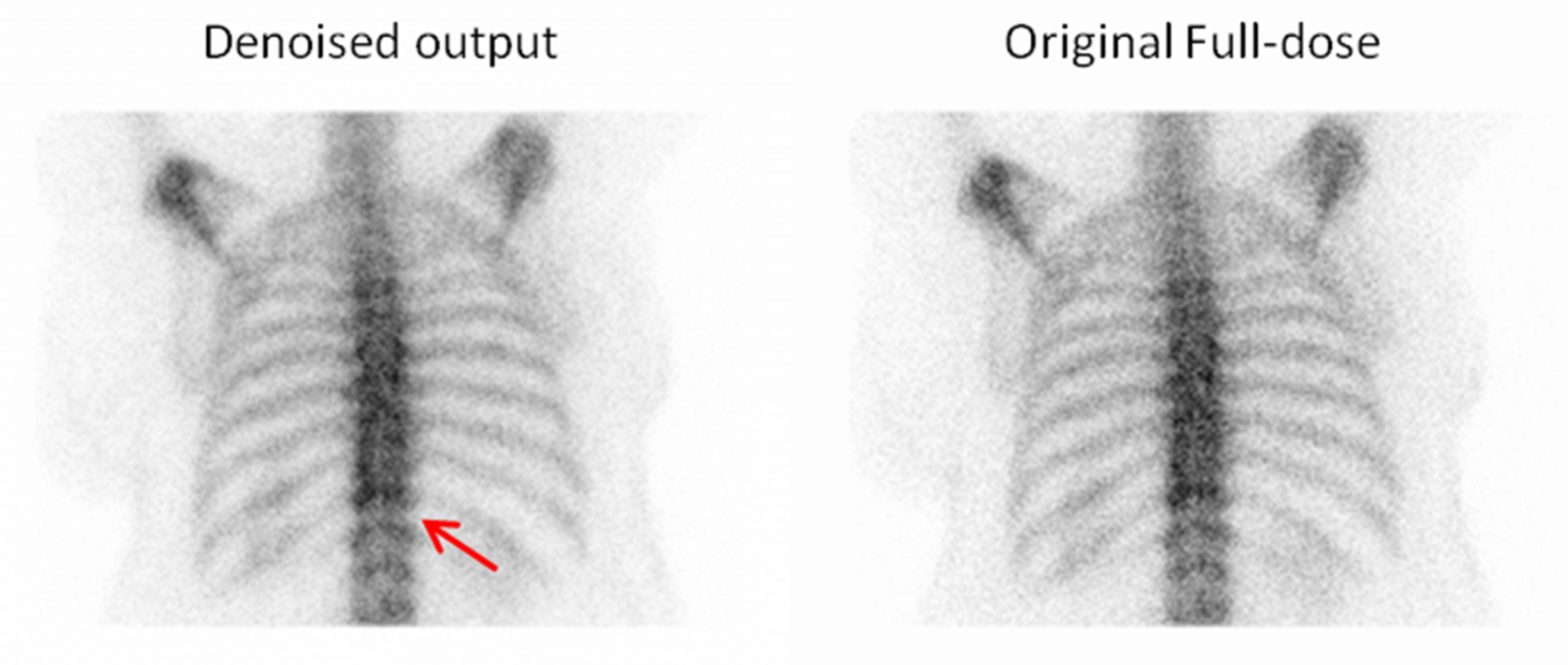 Jimaging 11 00197 g014