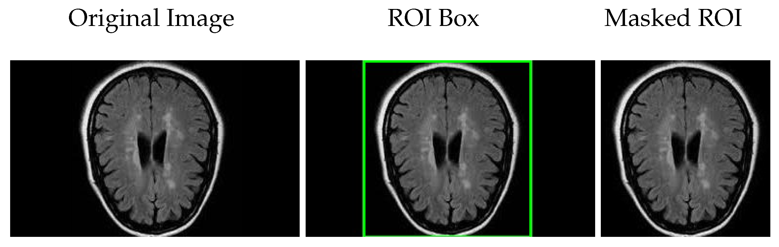 Jimaging 11 00207 g003