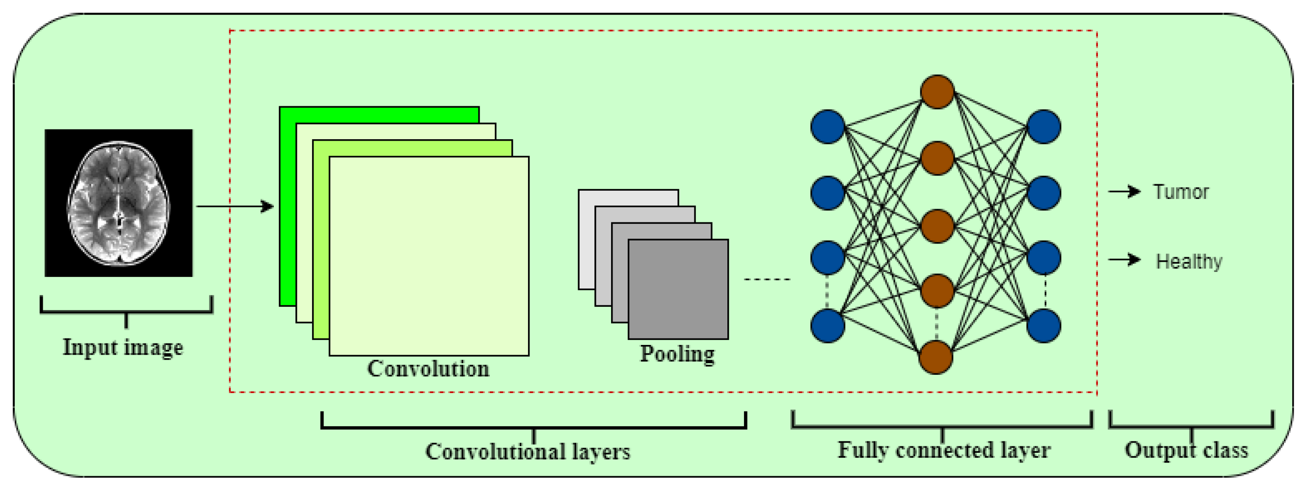 Jimaging 11 00207 g005