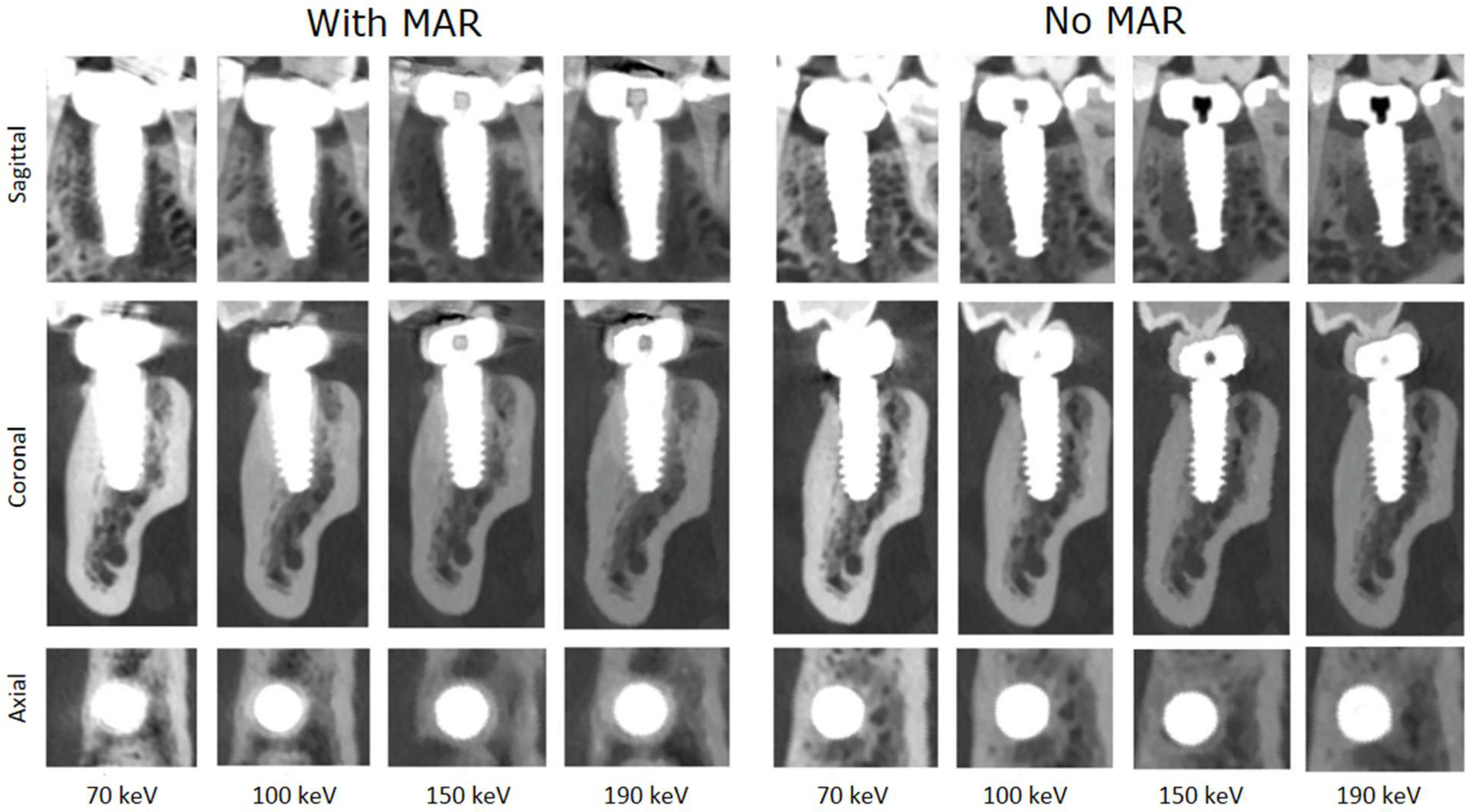 Jimaging 11 00215 g003