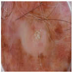 Jimaging 11 00235 i003