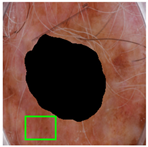 Jimaging 11 00235 i006