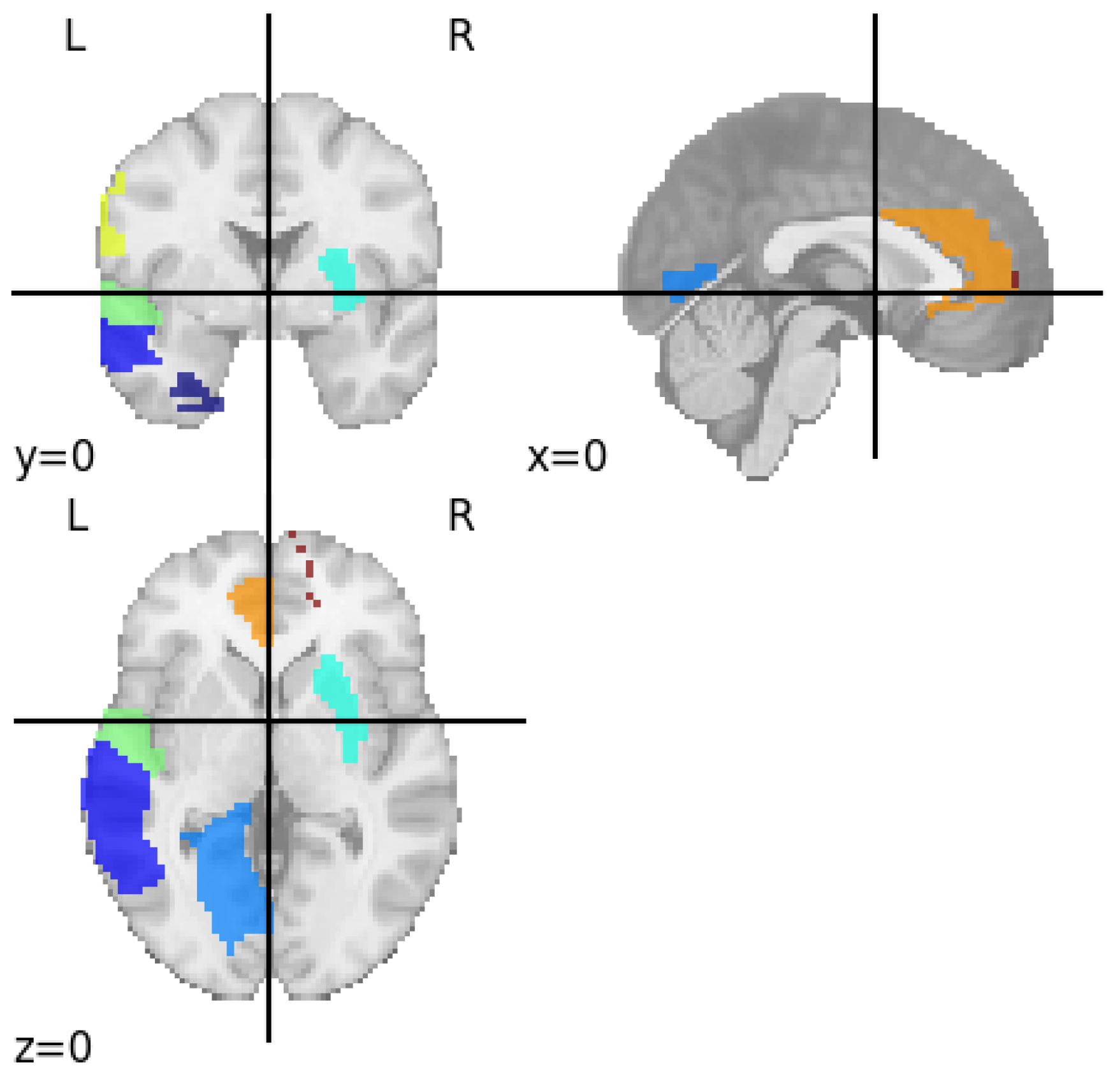 Detection of Major Depressive Disorder from Functional