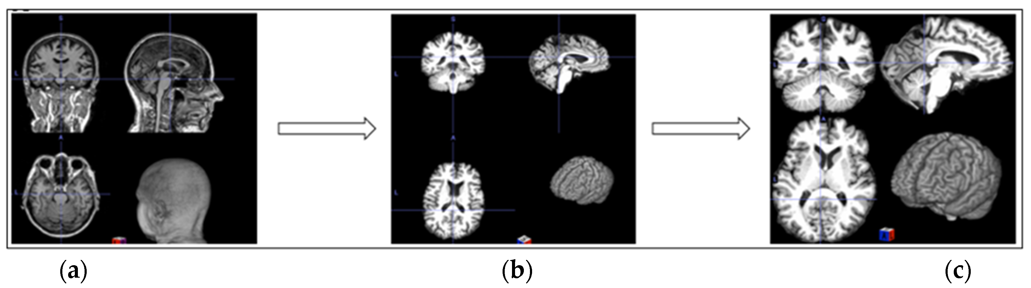 Jimaging 11 00260 g002