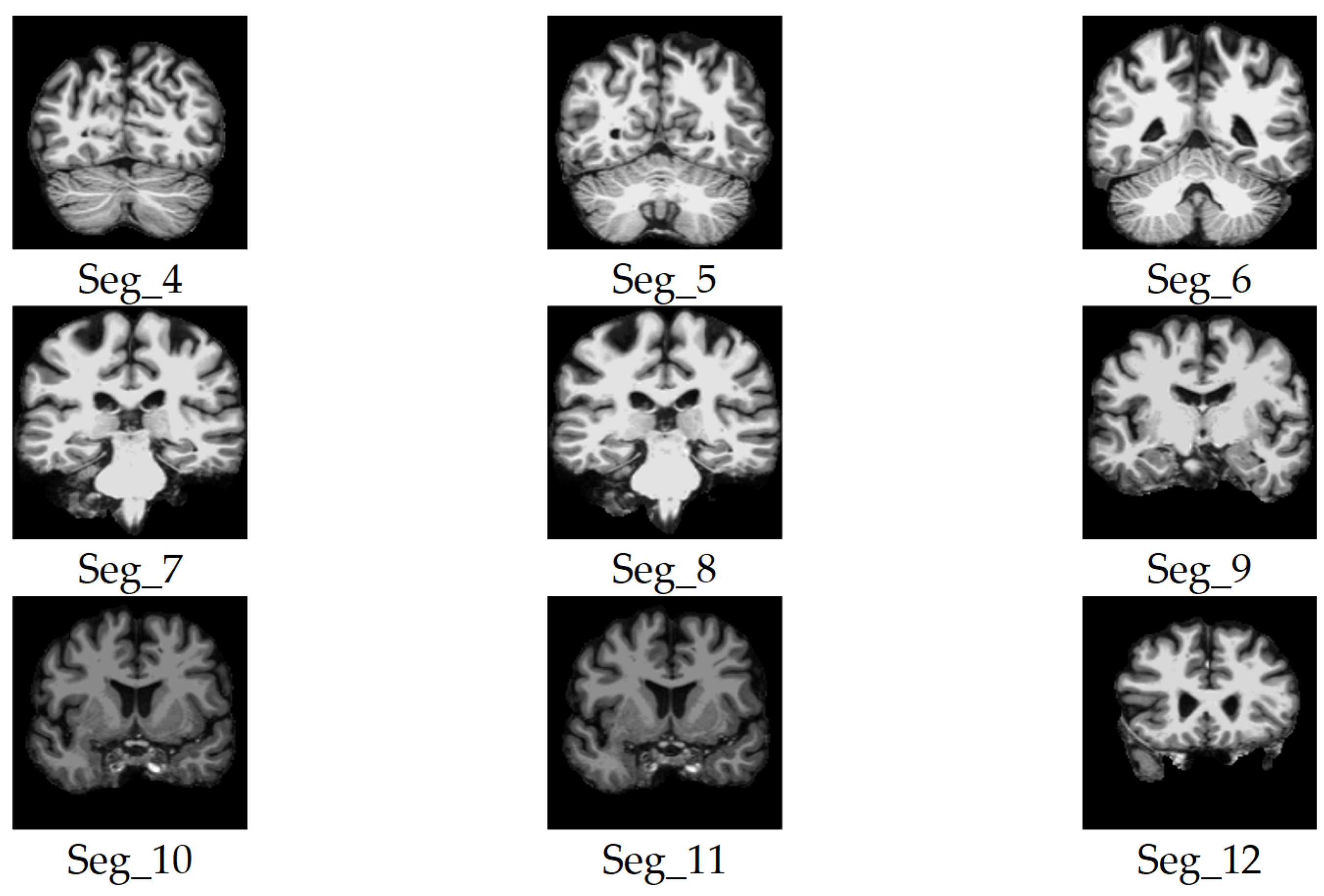 Jimaging 11 00260 g004