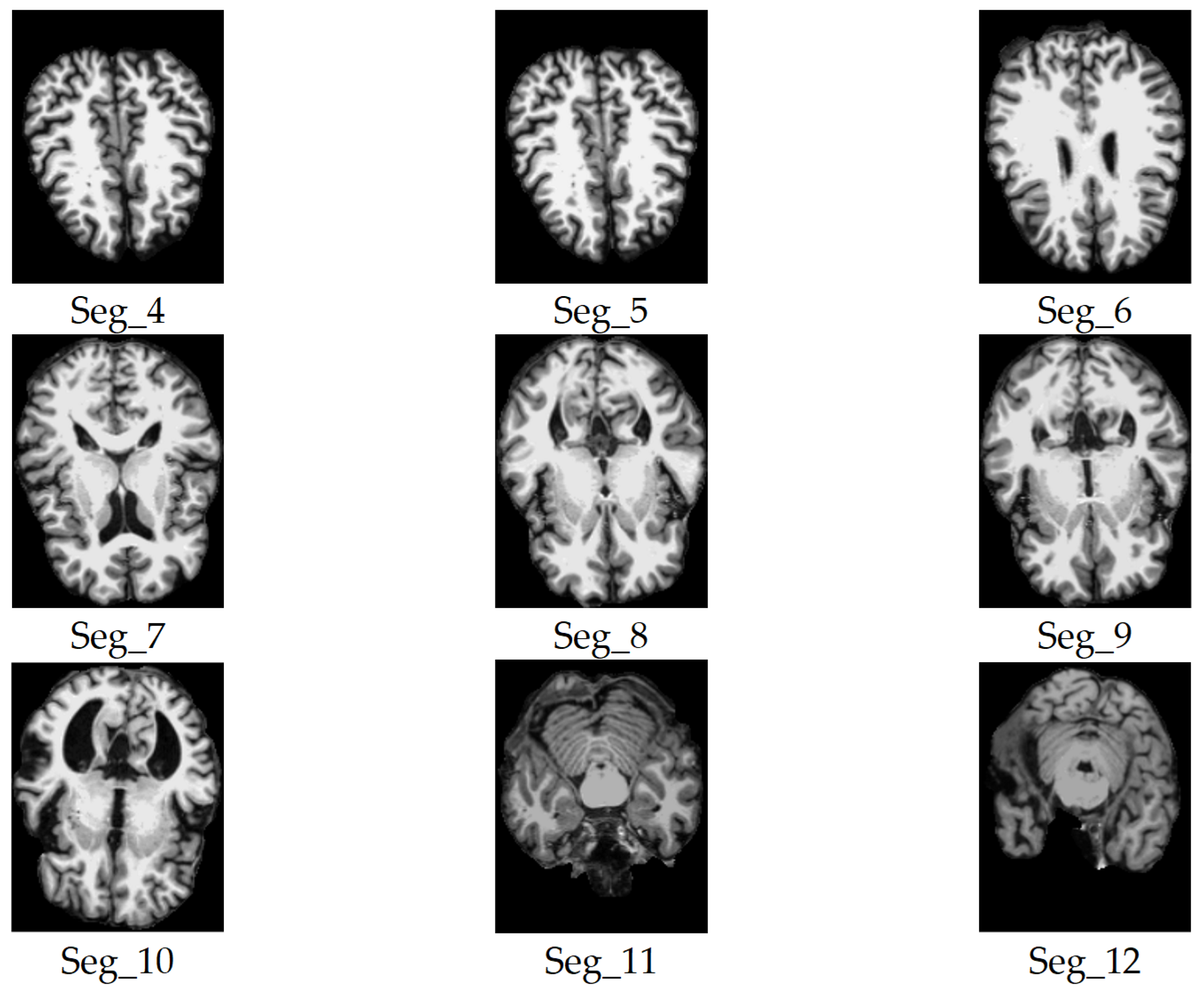 Jimaging 11 00260 g005