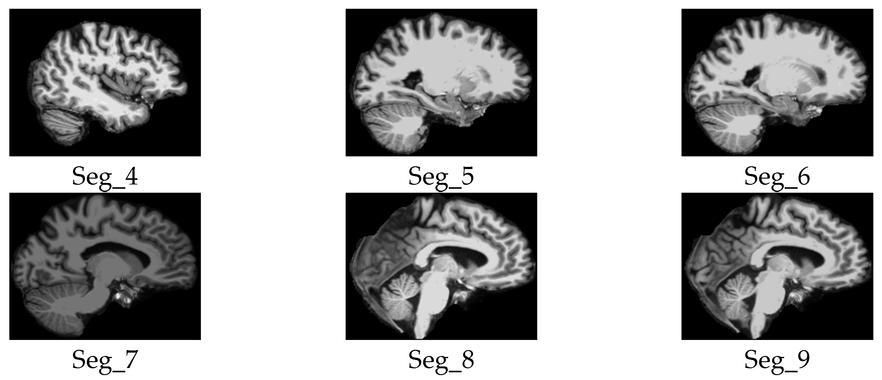 Jimaging 11 00260 g006a