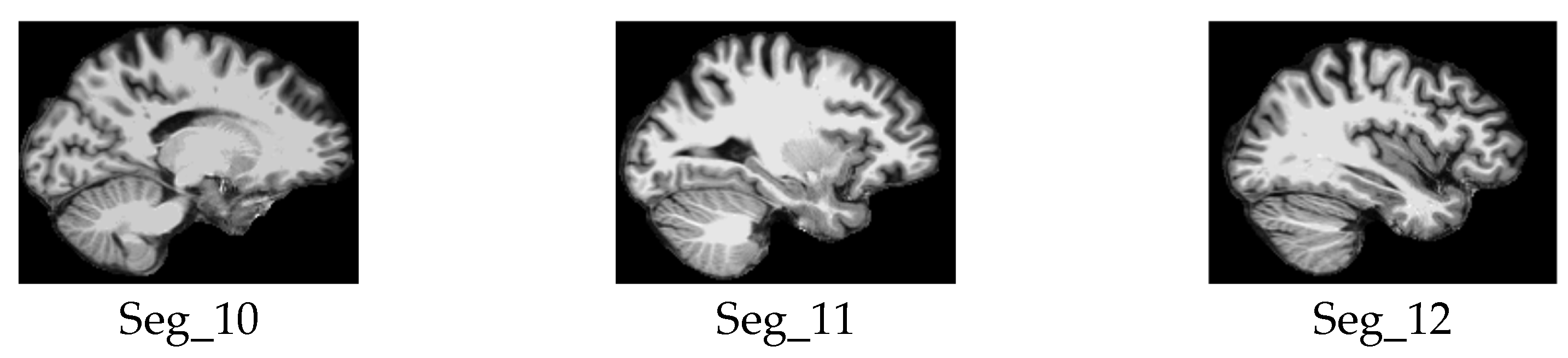 Jimaging 11 00260 g006b