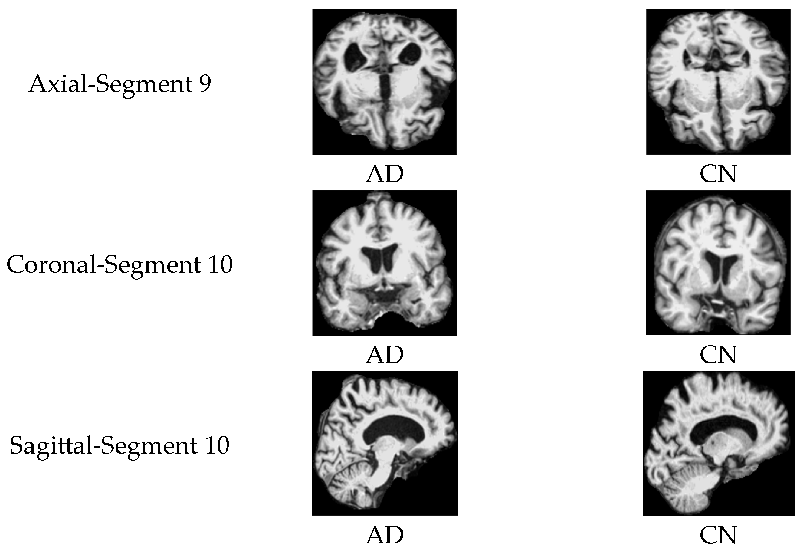 Jimaging 11 00260 g012