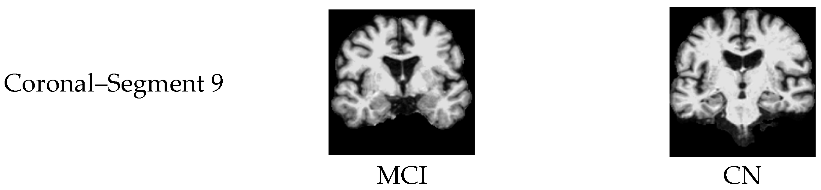 Jimaging 11 00260 g013