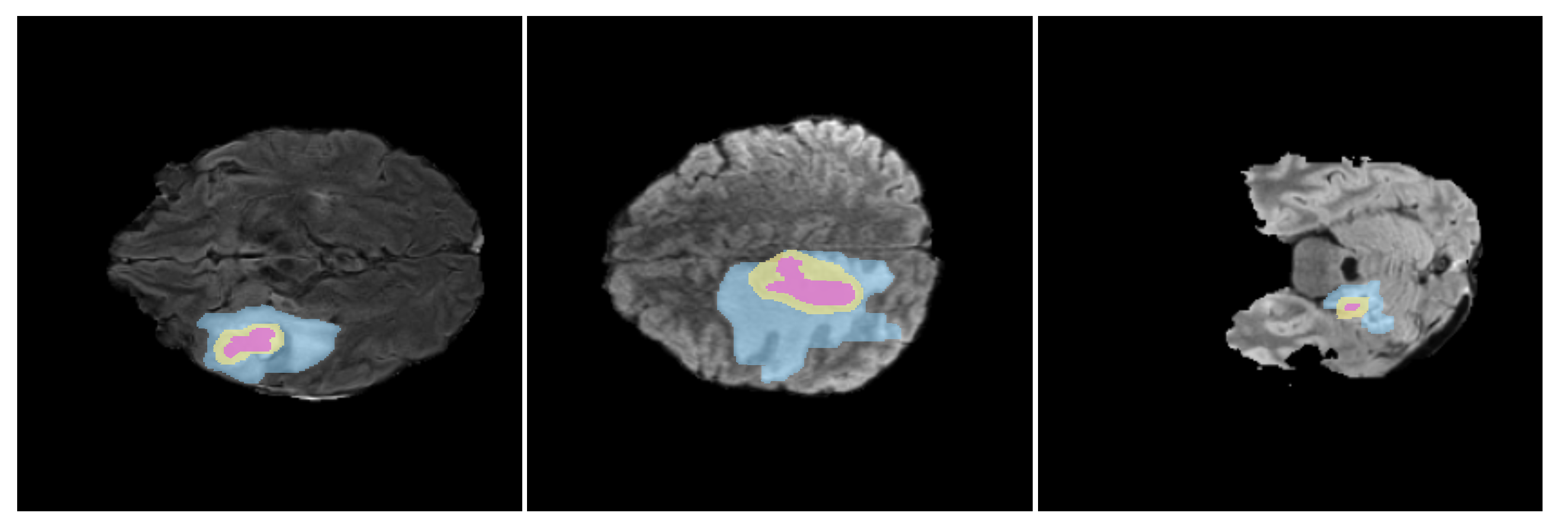 Jimaging 11 00269 g005 Jimaging 11 00269 g005