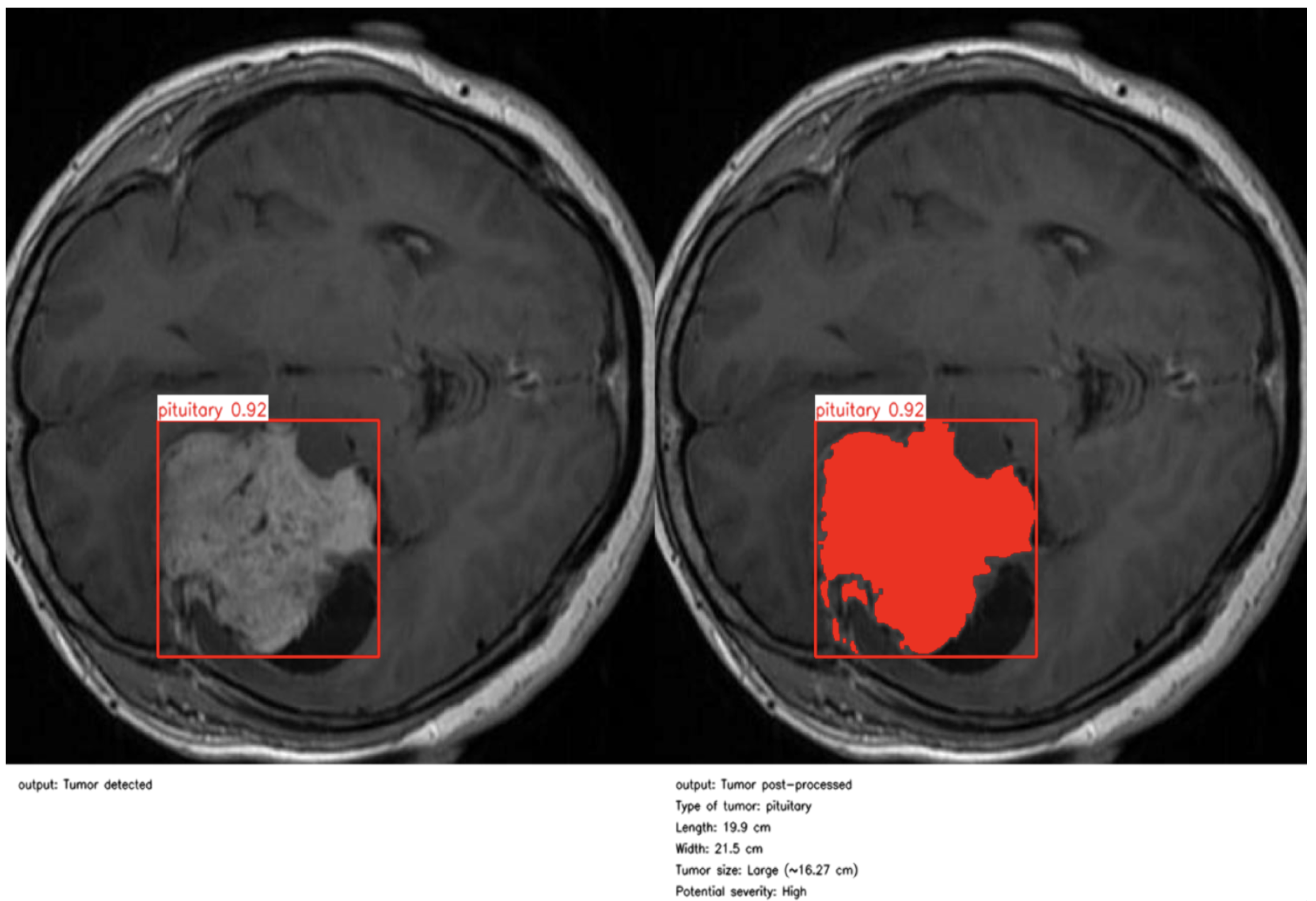 Jimaging 11 00282 g004