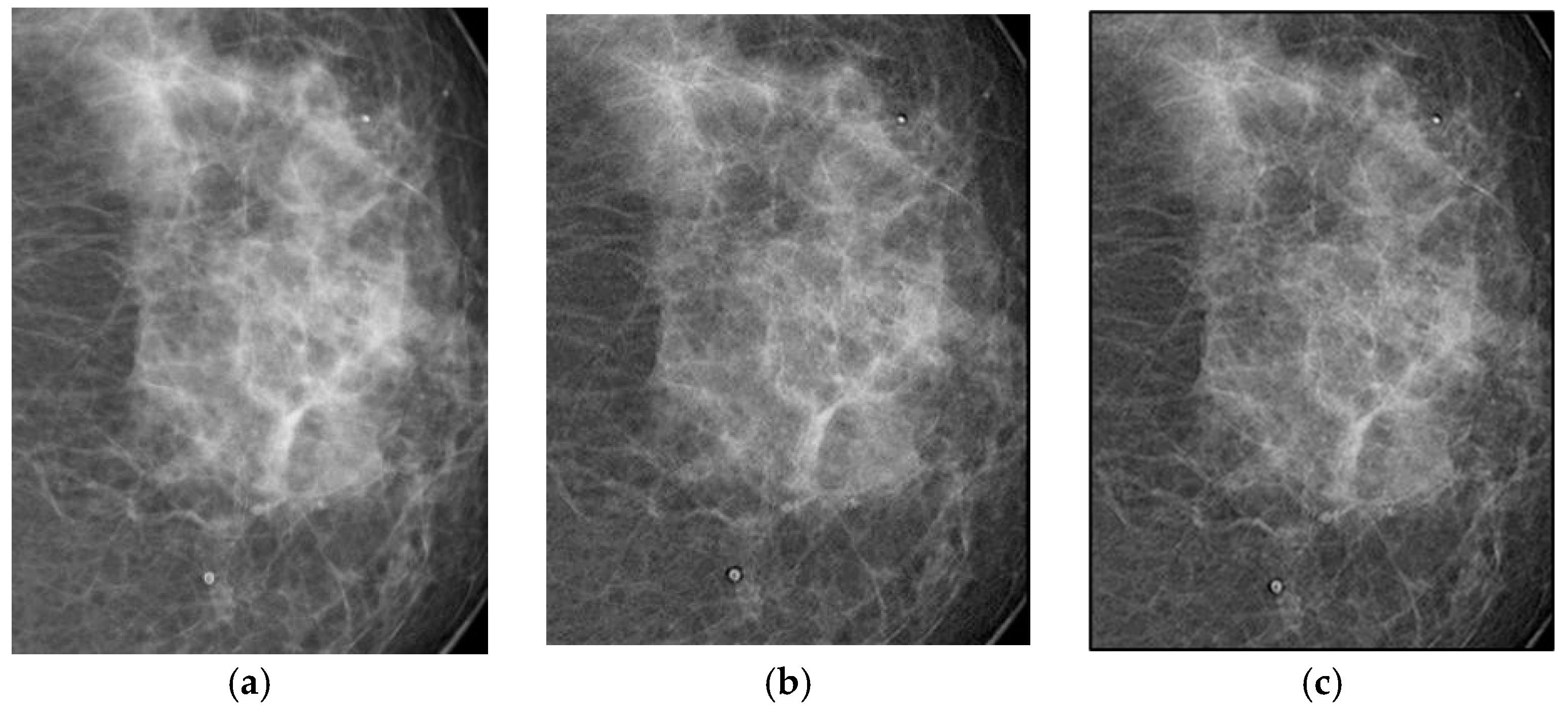 Jimaging 11 00291 g004