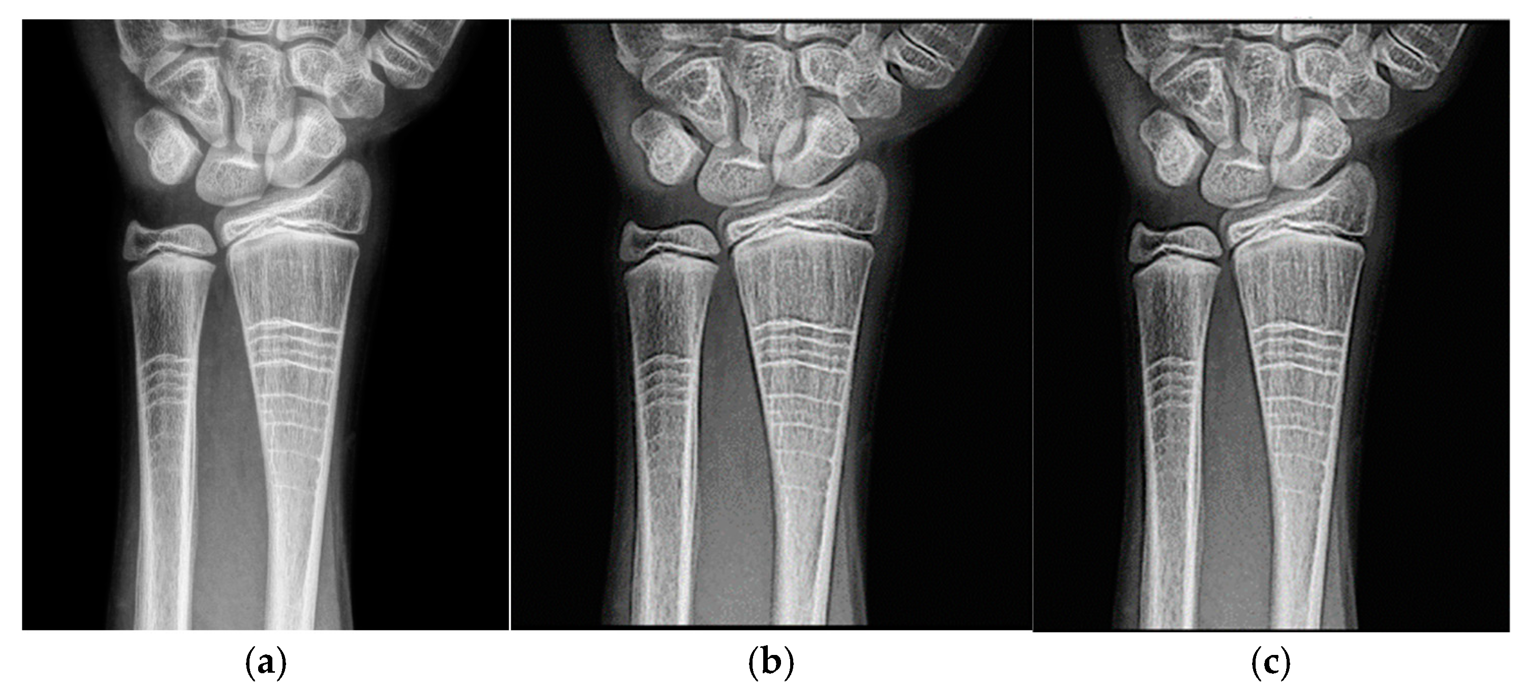 Jimaging 11 00291 g007