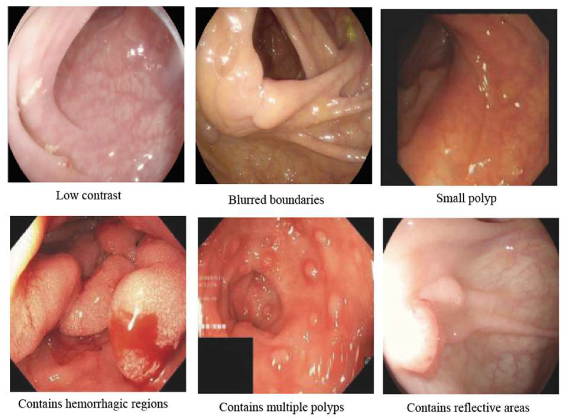 Jimaging 11 00293 g004 Jimaging 11 00293 g004