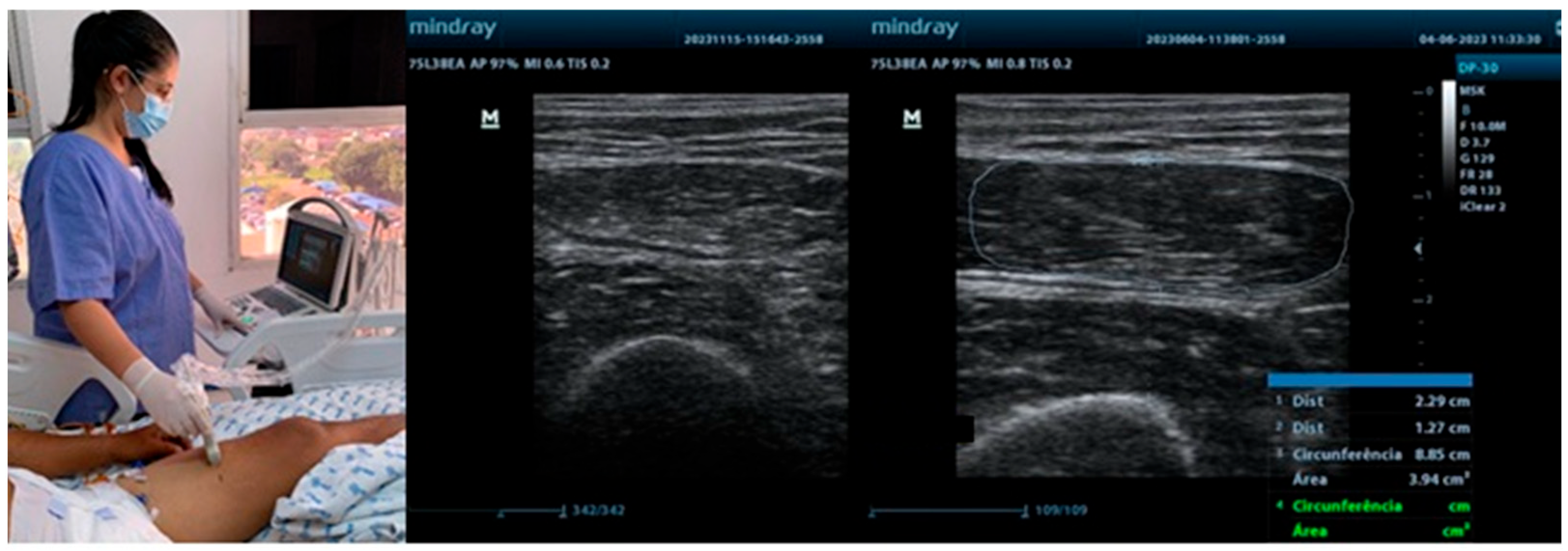 Jimaging 11 00297 g001