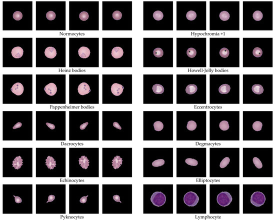 A Hybrid Framework for Red Blood Cell Labeling Using Elliptical