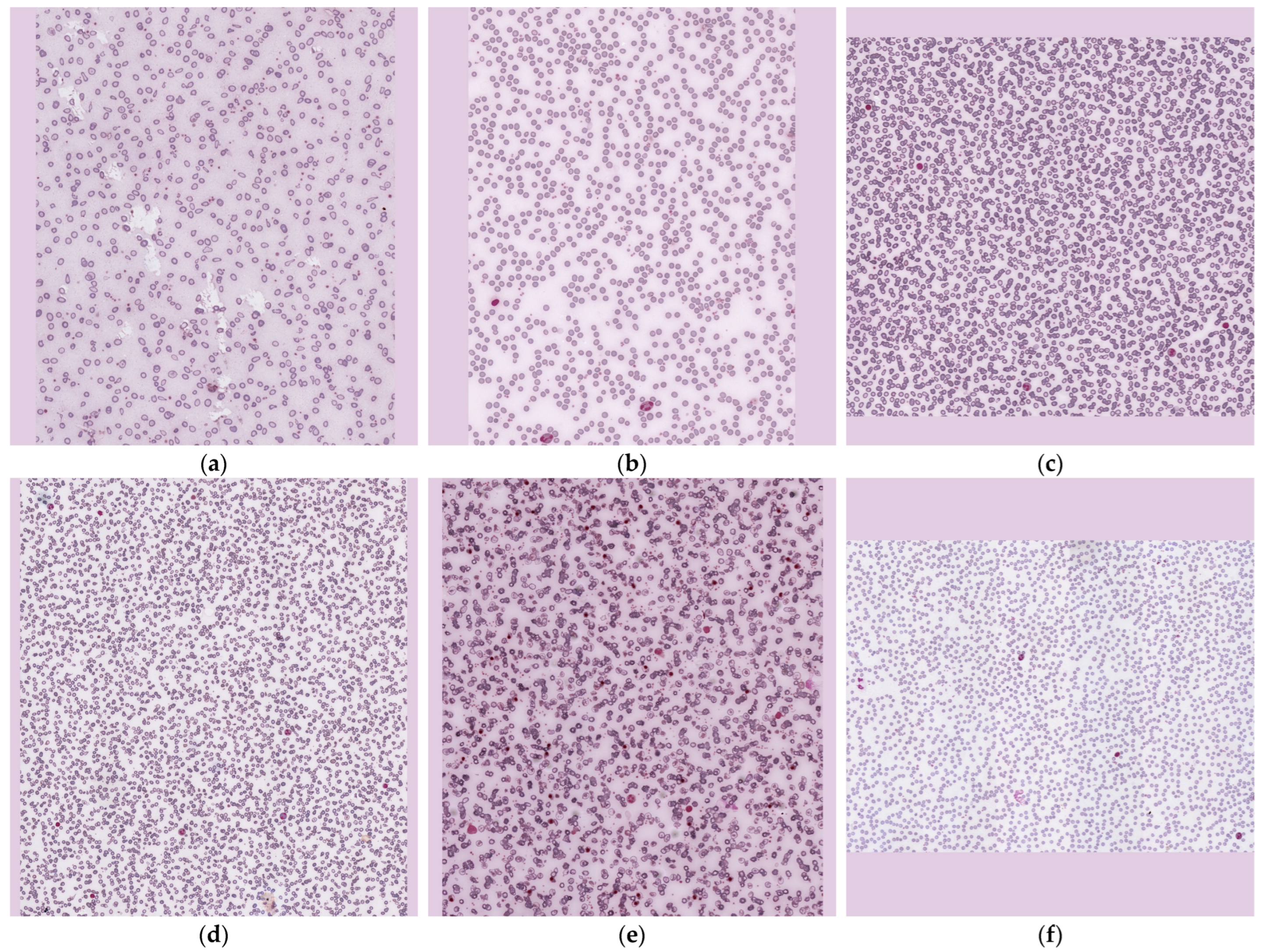 Jimaging 11 00309 g0a2 Jimaging 11 00309 g0a2