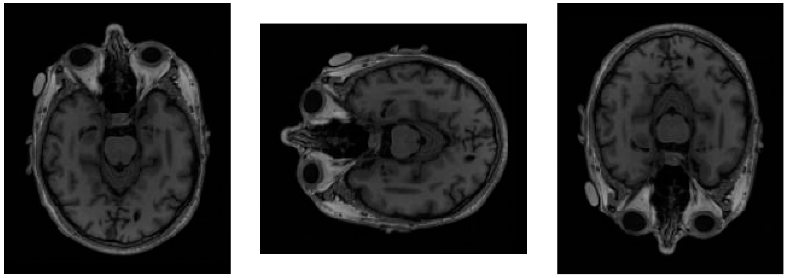 Jimaging 11 00311 g004