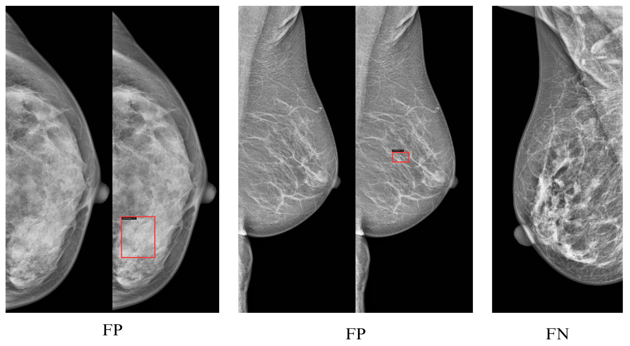 Jimaging 11 00314 g009 Jimaging 11 00314 g009