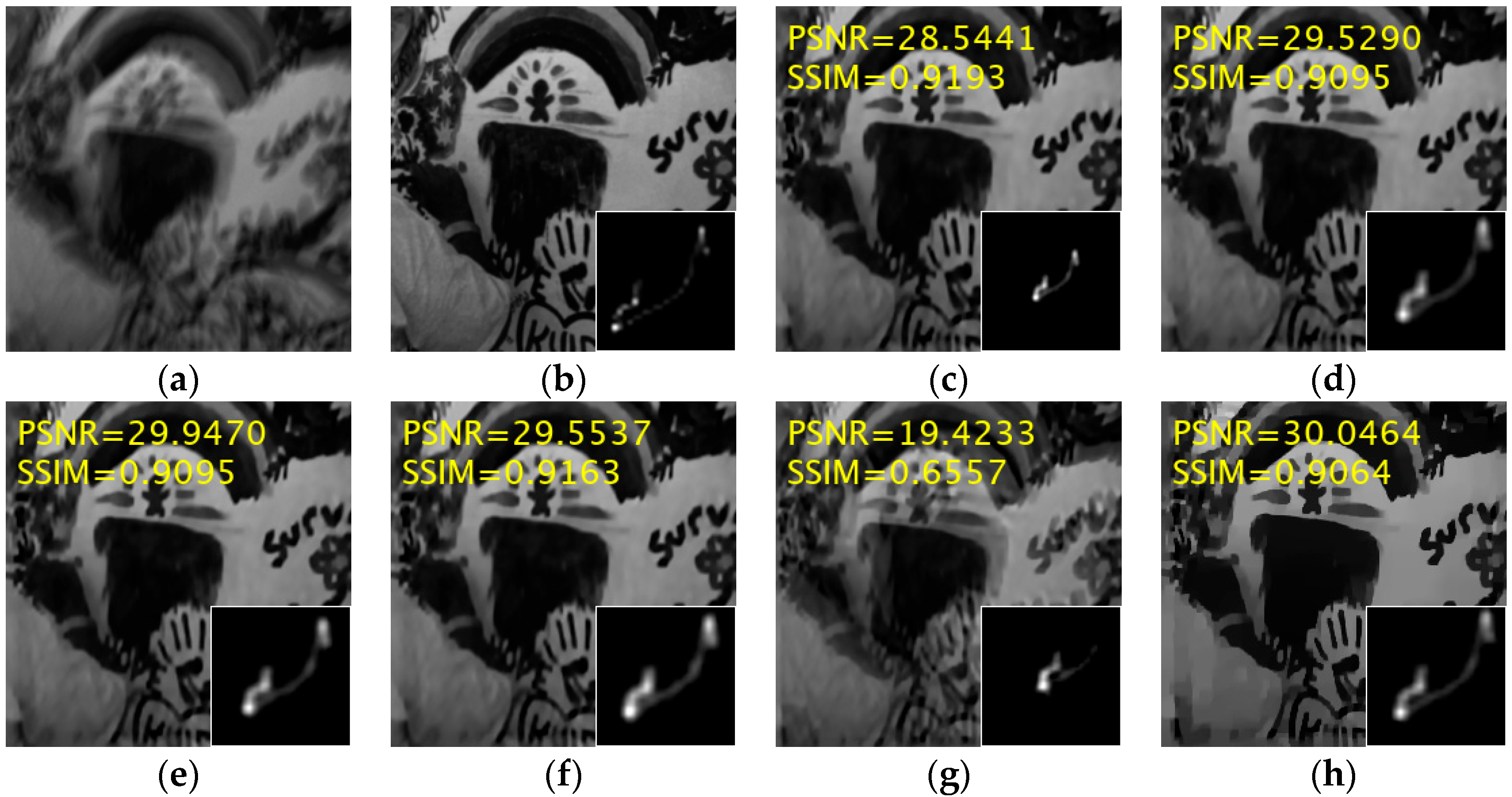 Jimaging 11 00327 g004