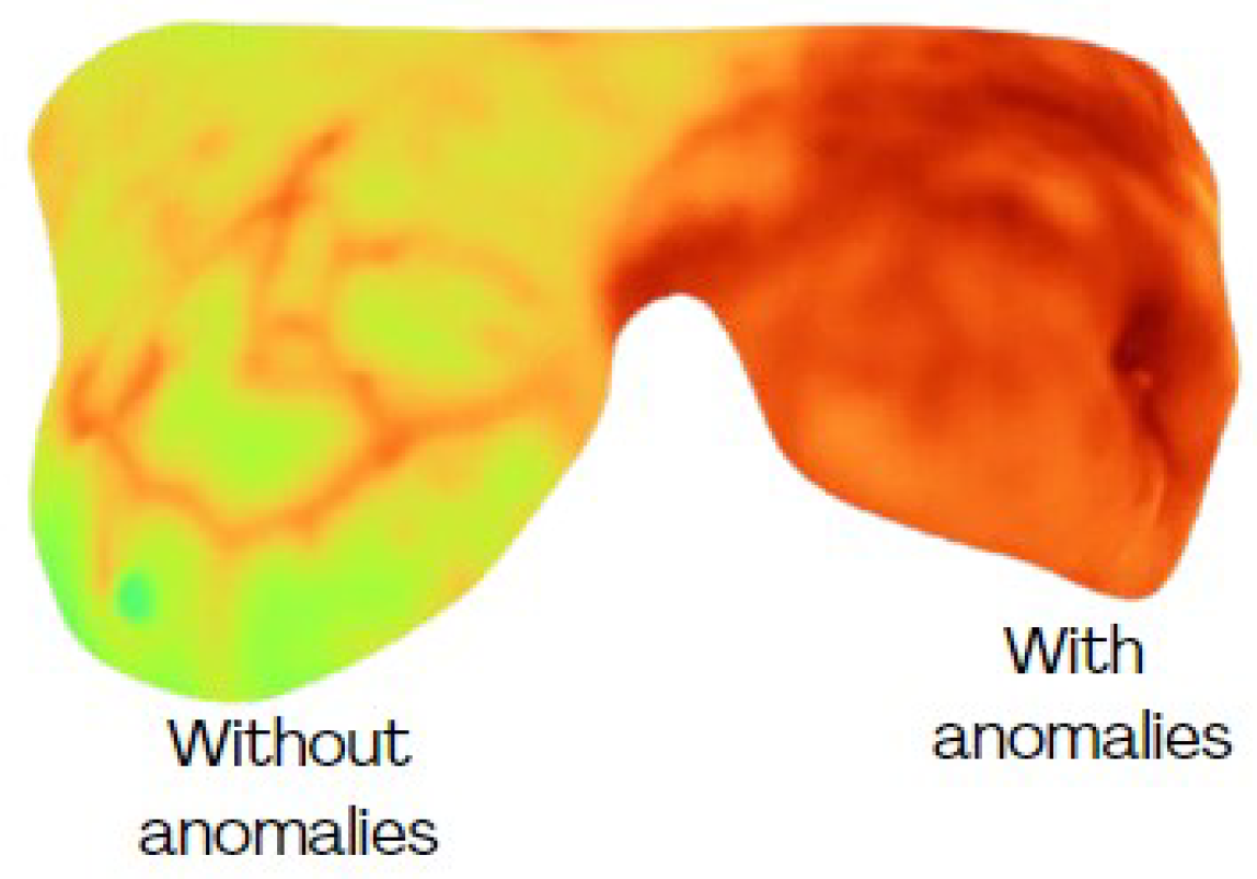 Jimaging 11 00358 g004