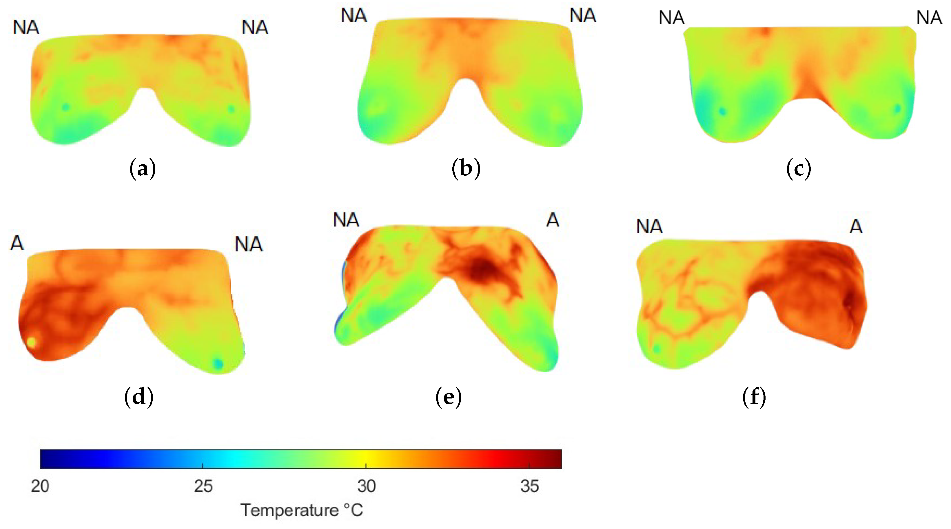 Jimaging 11 00358 g005