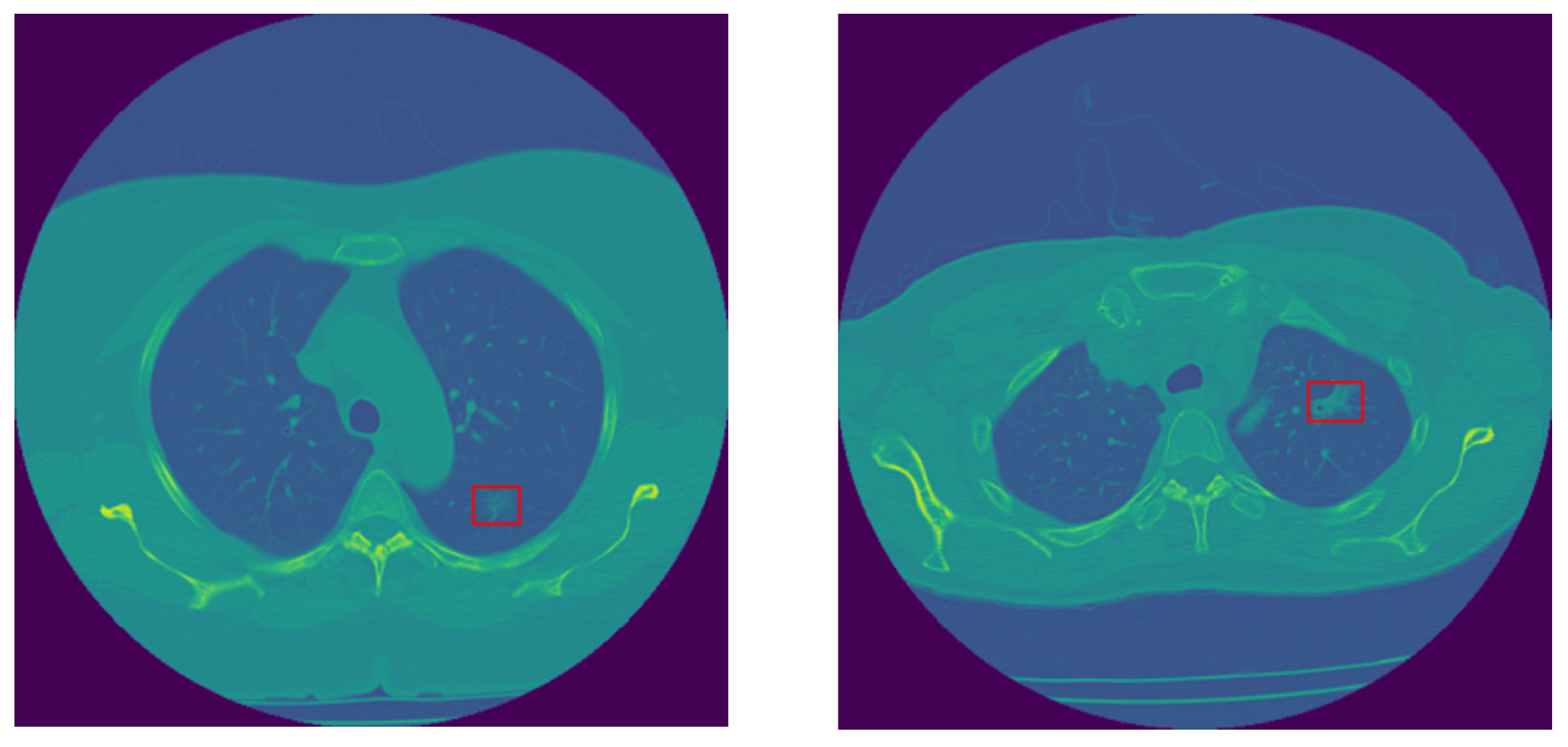 Jimaging 11 00360 g002 Jimaging 11 00360 g002