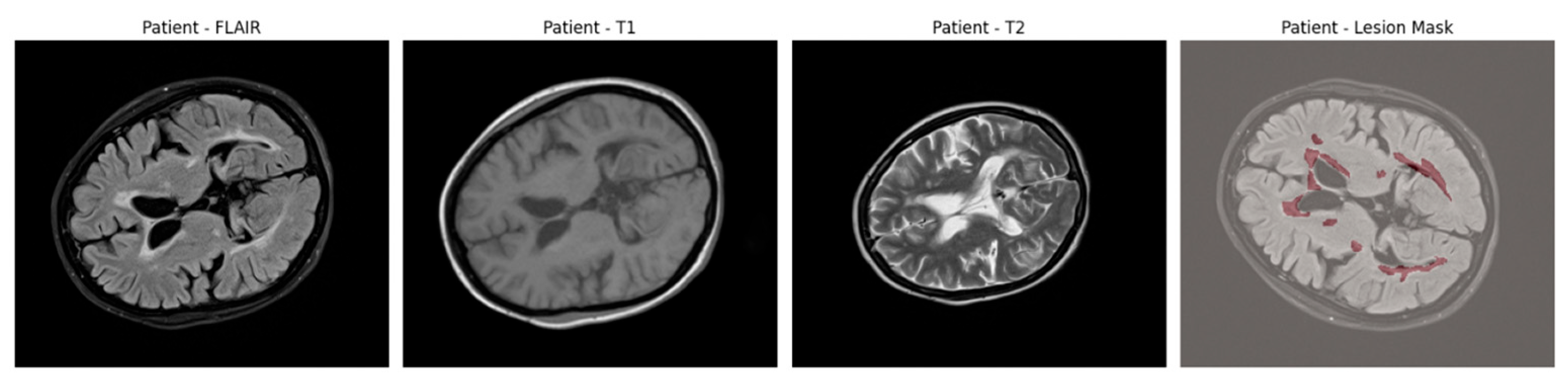 Jimaging 11 00361 g001