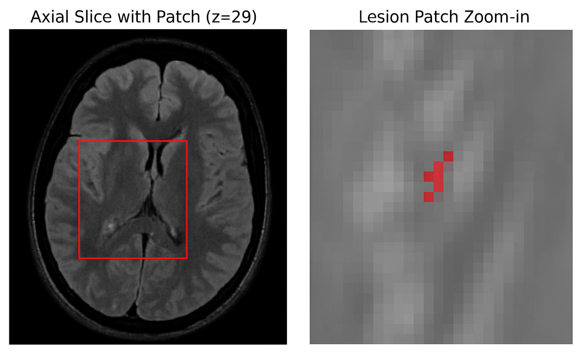 Jimaging 11 00361 g004