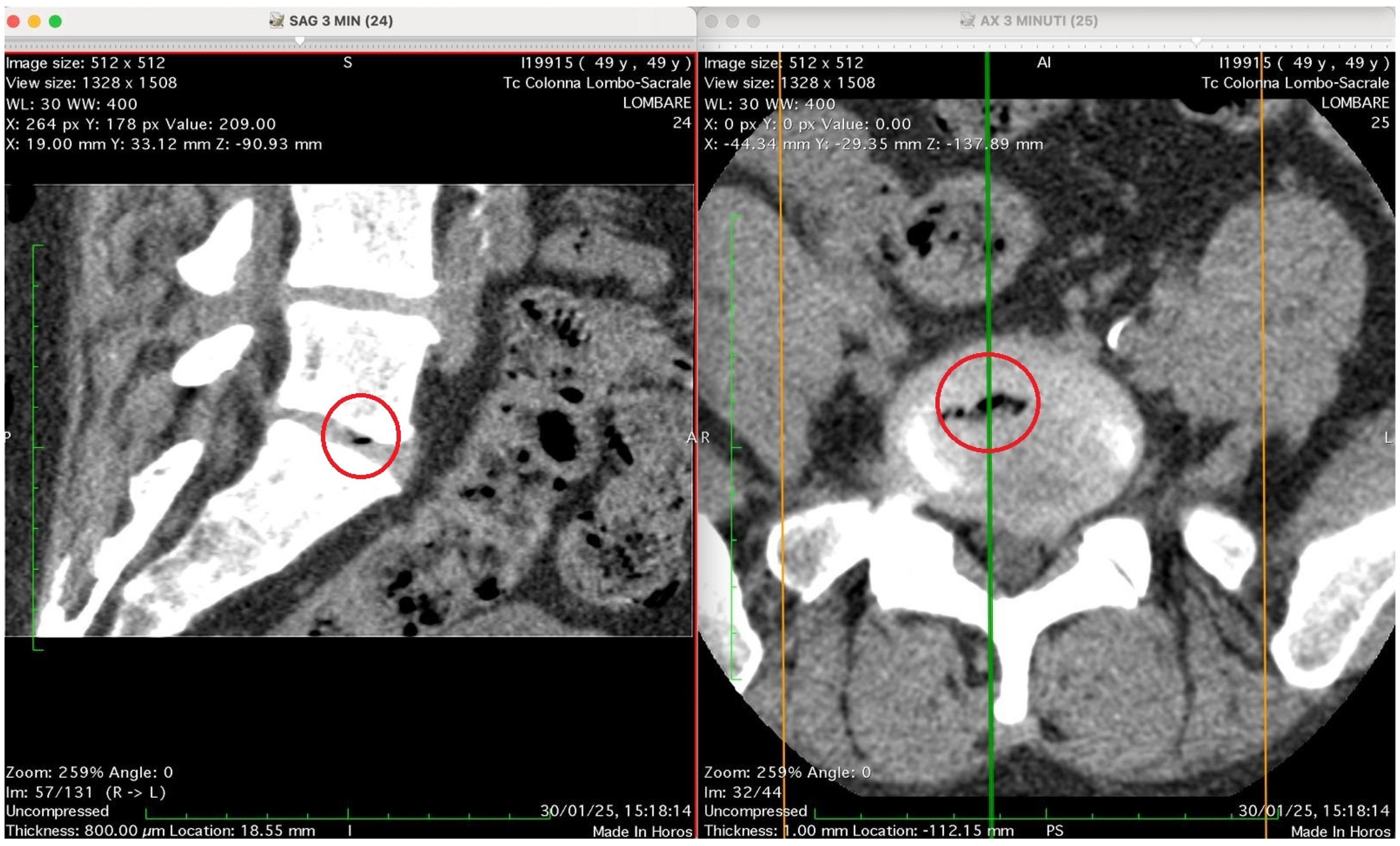 Jimaging 11 00428 g003