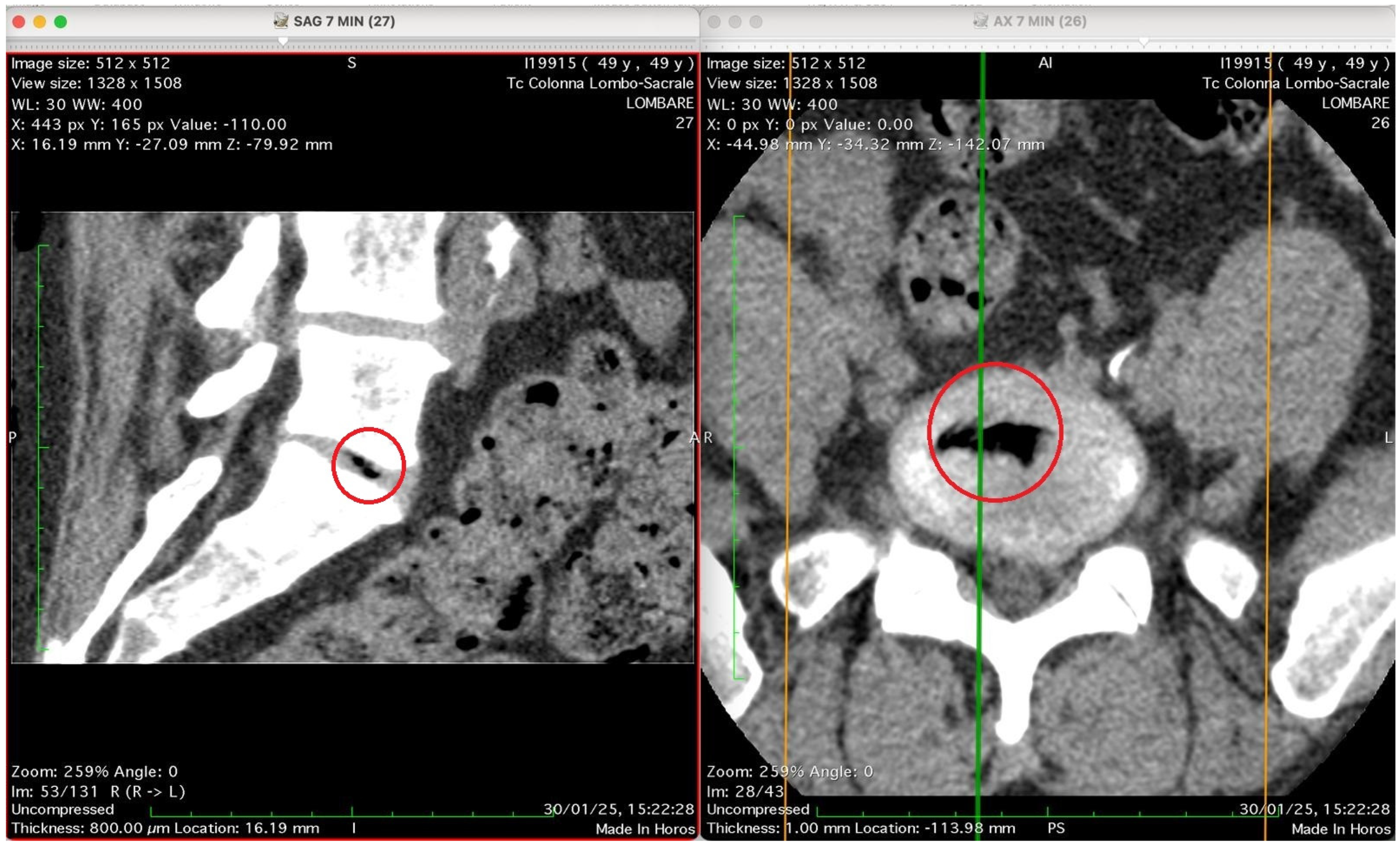 Jimaging 11 00428 g004