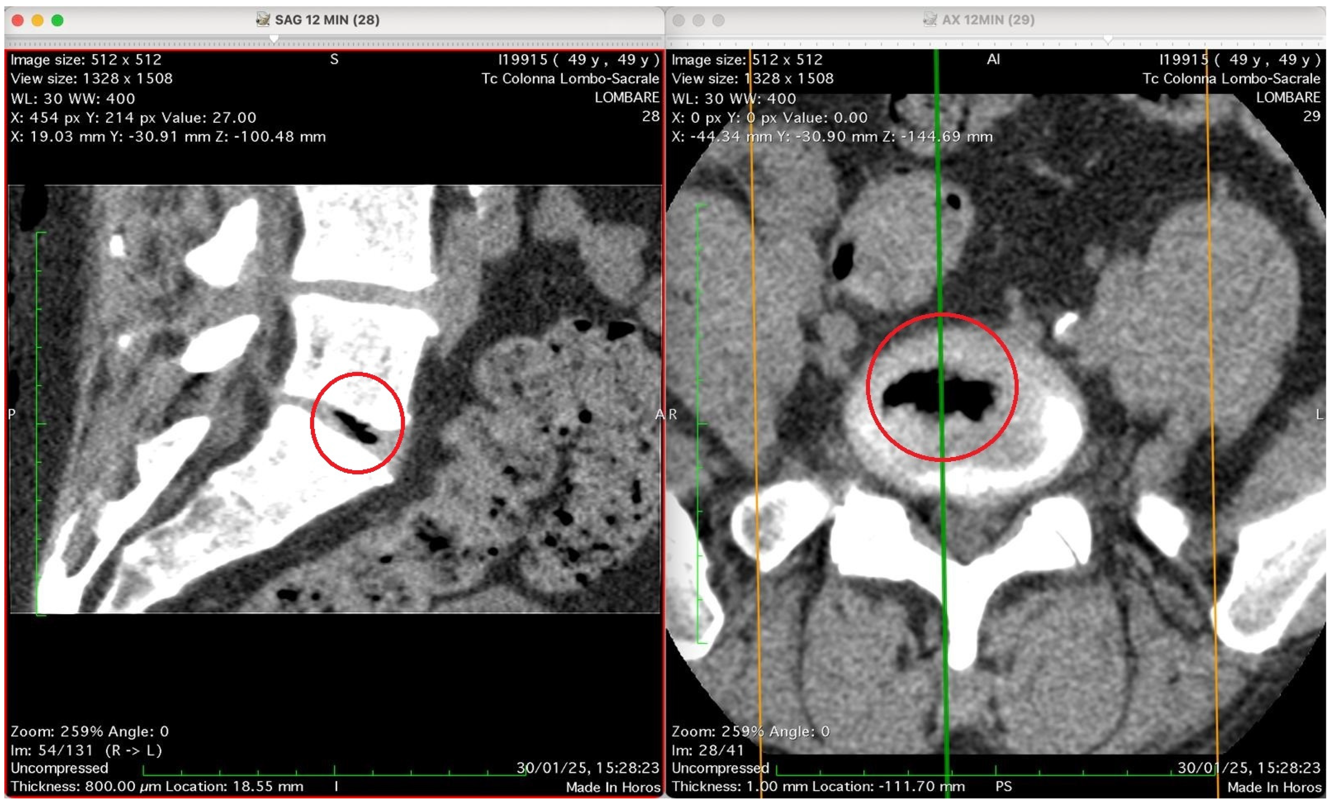 Jimaging 11 00428 g005