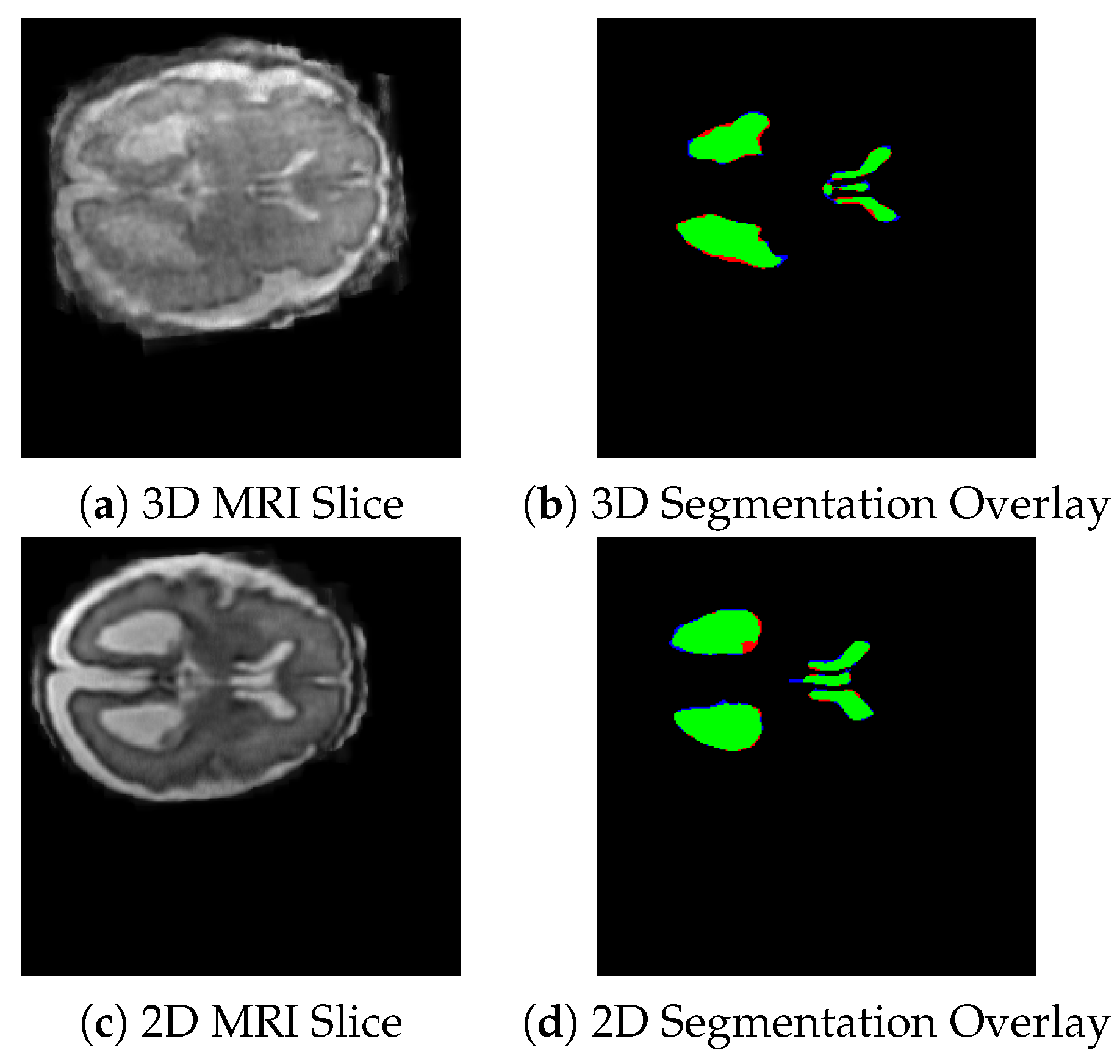 Jimaging 11 00444 g004
